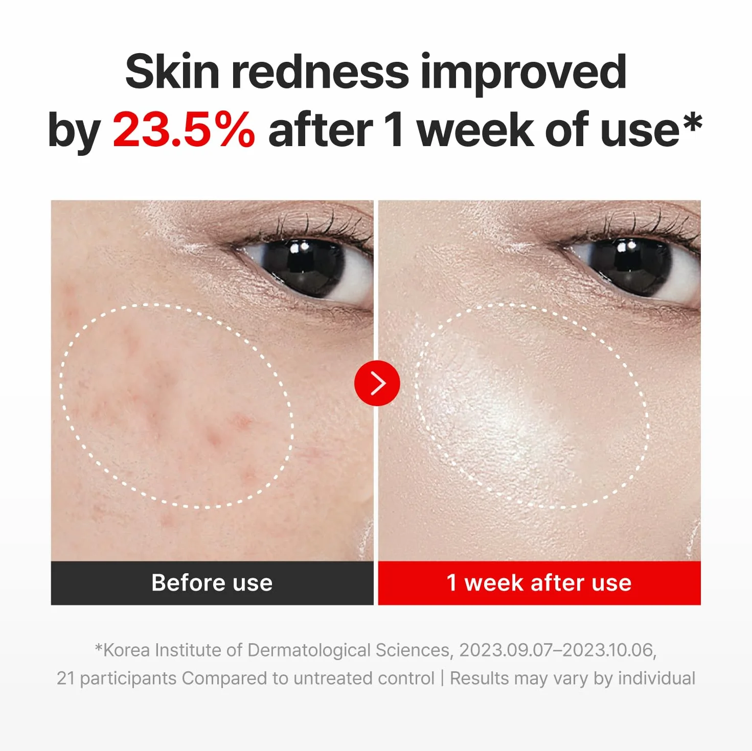CENTELLIAN 24 Madeca Cream Time Reverse (50 ml) – Avanzato ad assorbimento rapido e nutriente, idrata, rassoda e riduce le rughe, bassa irritazione, cura della pelle coreana Centella asiatica