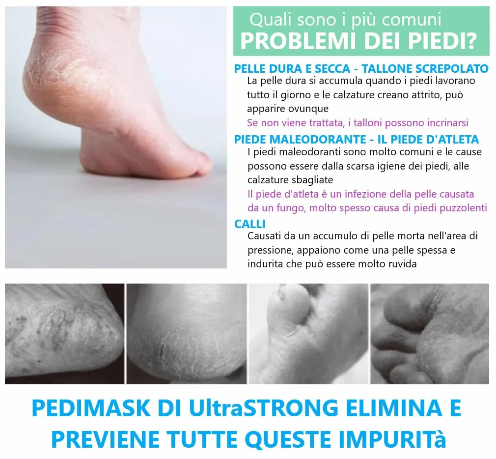 Pedimask Maschera Piedi Esfoliante Idratante UltraSTRONG IT - Rimuovere Calli Pelle Morta - Pulizia Profonda - Dermatologicamente Testato (ALOE)