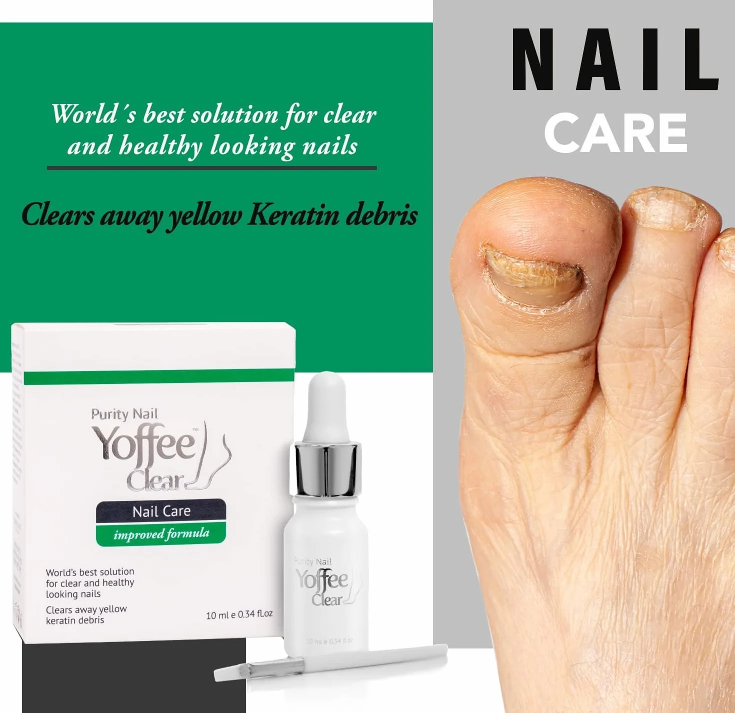 Yoffee Clear Purity Nail | Trattamento Micosi Unghie Piedi | Antimicotico Unghie | Con olio Bio di Argan e Tea Tree Oil | Antibatterico e Antisettico| Clinicamente provato| 10ml | Made in Spain