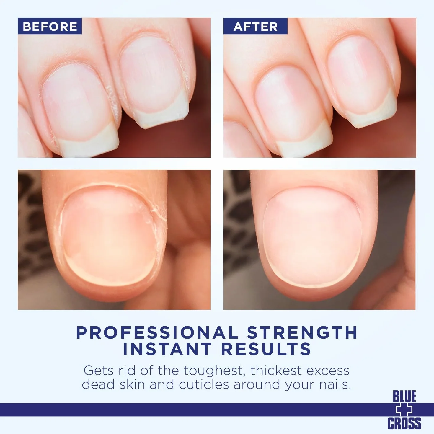 Blue Cross Cuticle Remover 180ml