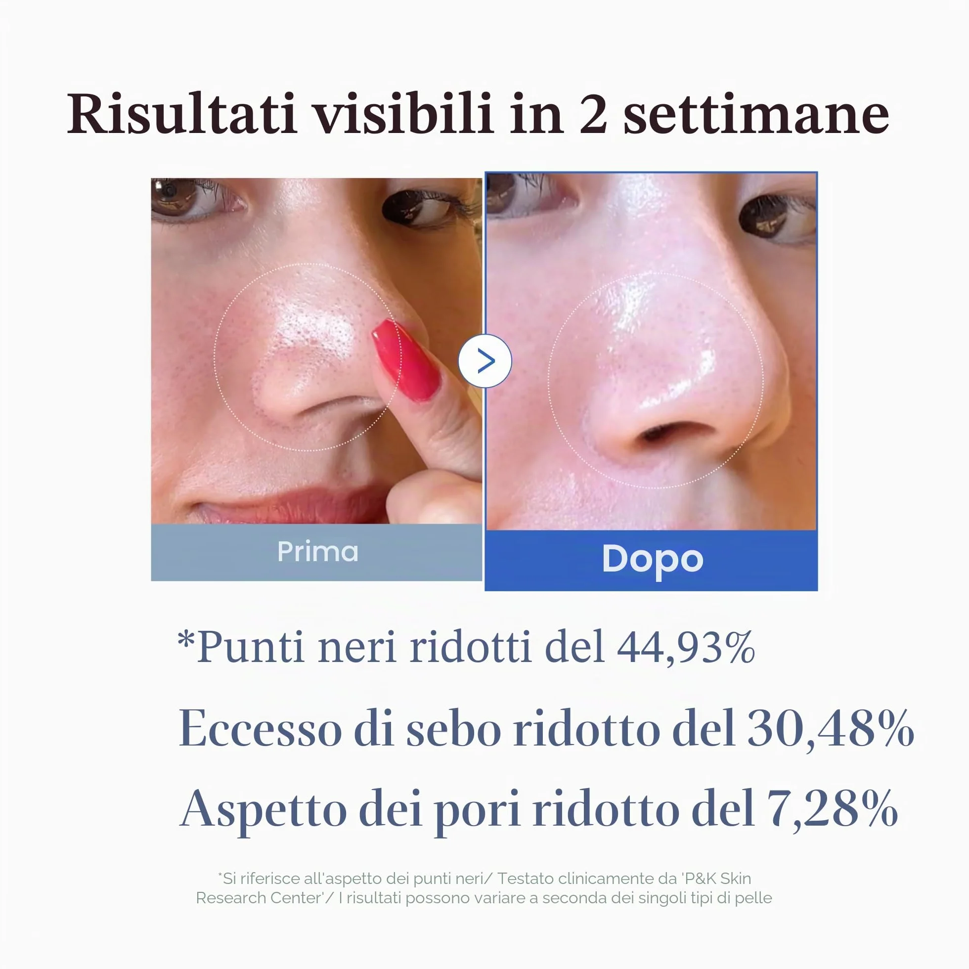 Medicube Zero Pore Pads 2.0 Tamponi Tonici Viso Esfoliazione Cura Pori Acido Lattico 4,5% Acido Salicilico BHA 0,45% 70 Unità
