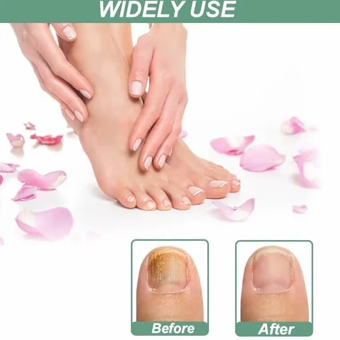 4 Pezzi Nail Care Pen, Penna per la Cura Delle Unghie, Arricchito con Tea Tree Oil, Fiori di Camomilla, Aloe Vera
