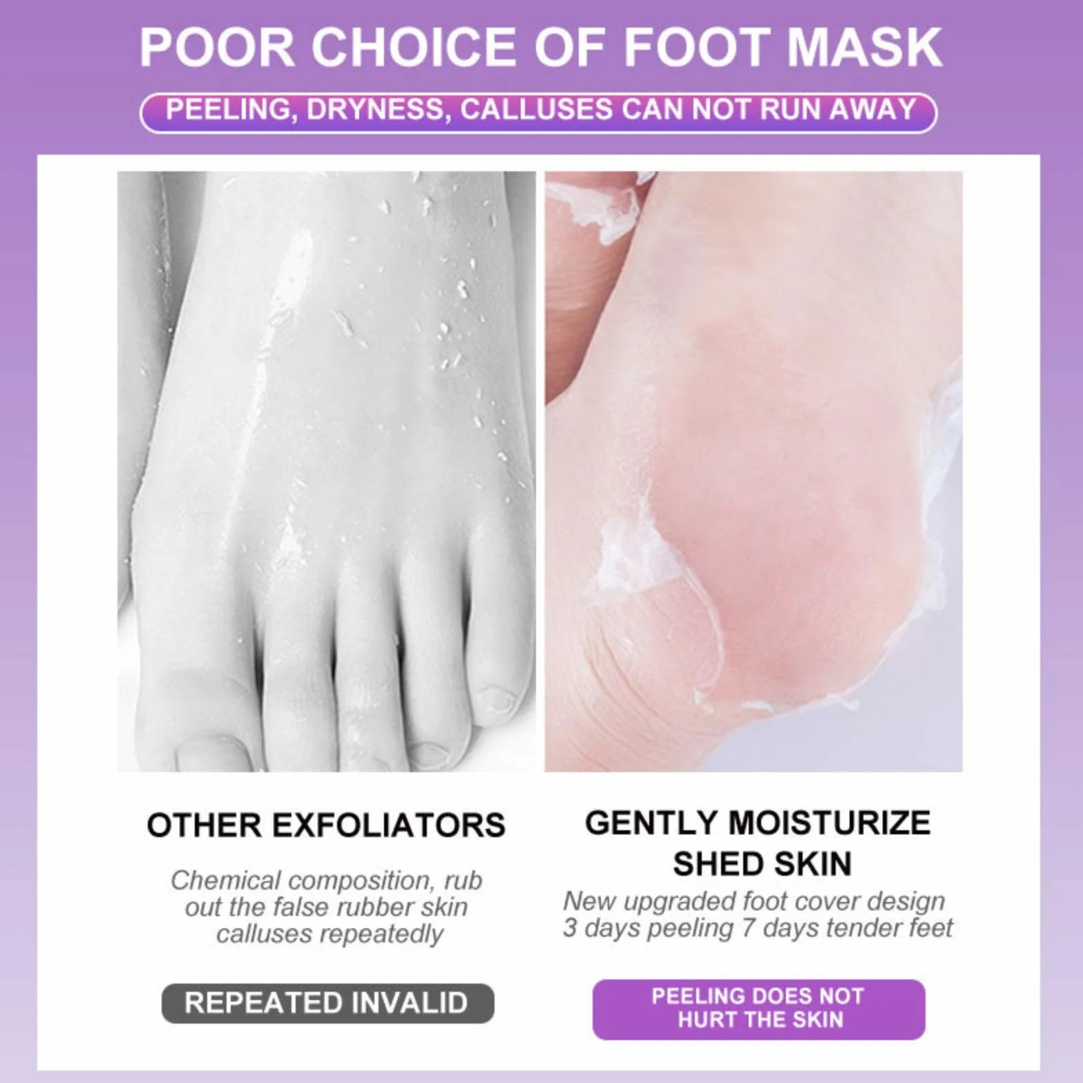 Joyeee Maschera Piedi Esfoliante, Lavender Foot Peel Mask, Efficace Peeling Piedi, Scrub Piedi e rimozione Calli dei Piedi, per Uomini e Donne, 5 paia