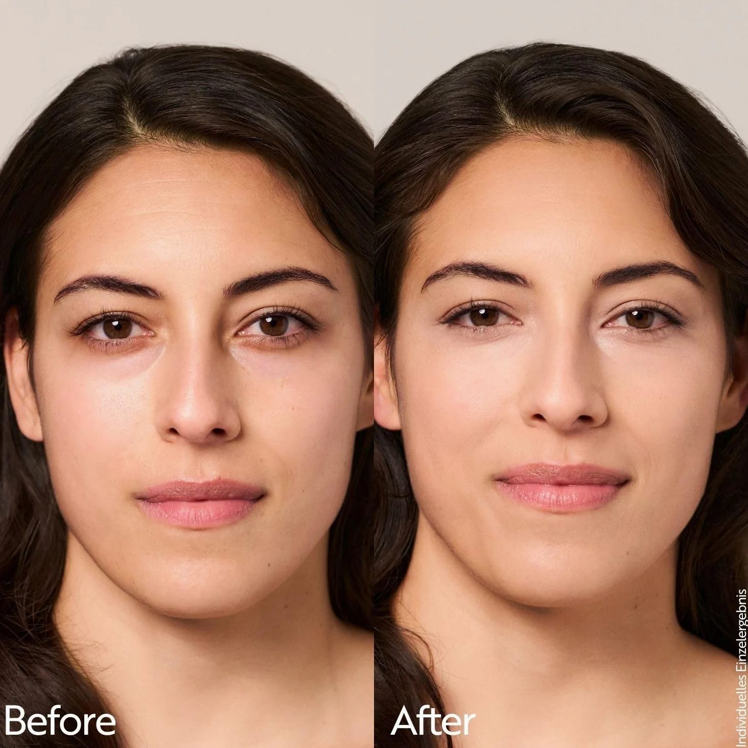 M. Asam Magic Finish Supercharge Serum Foundation Warm Sand (30 ml) | Fondotinta idratante e siero rassodante per il viso, trucco anti-età con acido ialuronico e copertura ottimale