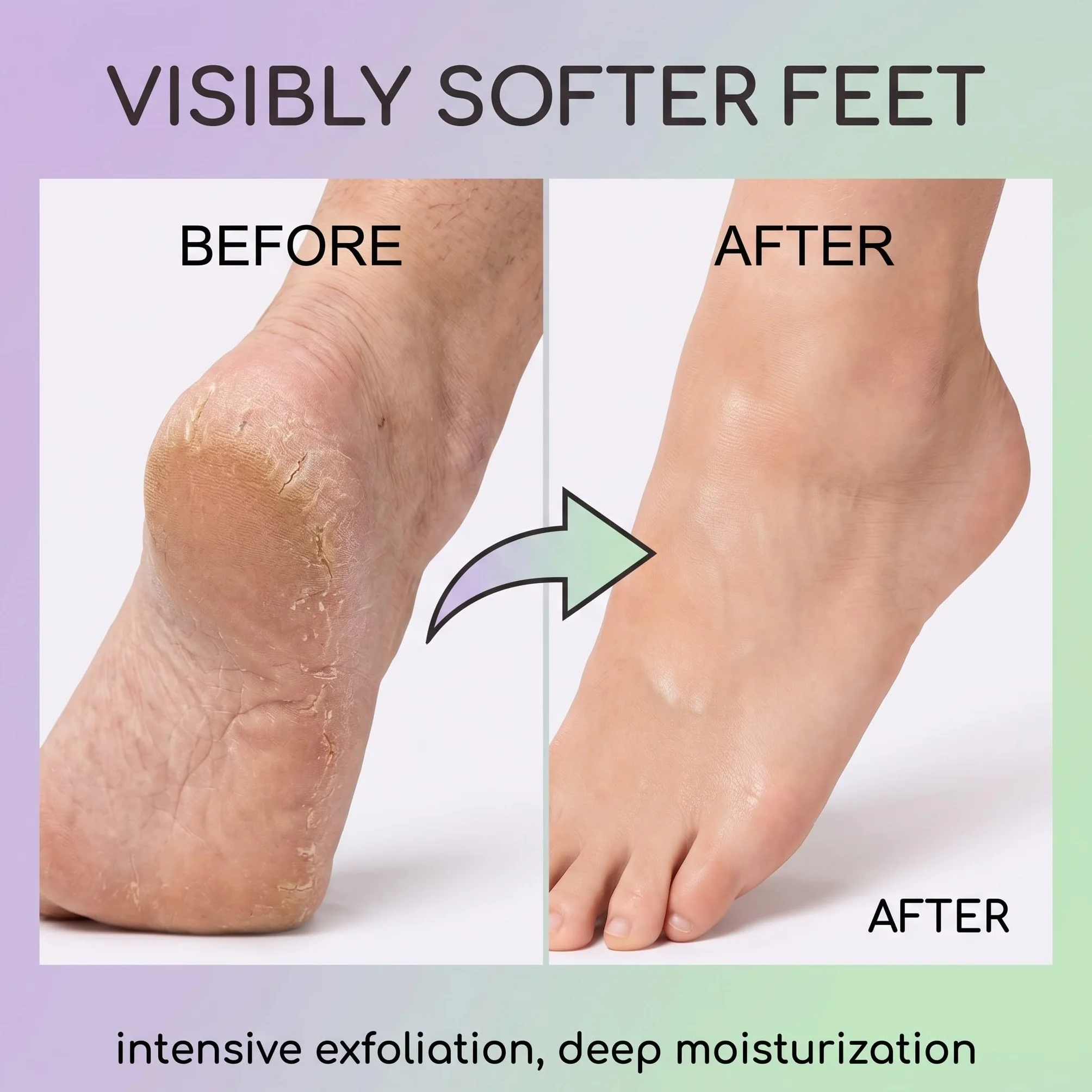 4 Paia Maschera Piedi Esfoliante e Idratante, Trattamento Peeling Piedi con Lavanda e Aloe Vera per Piedi Secchi, Calzini Esfolianti per Rimozione Pelle Morta e Calli, Donna e Uomo