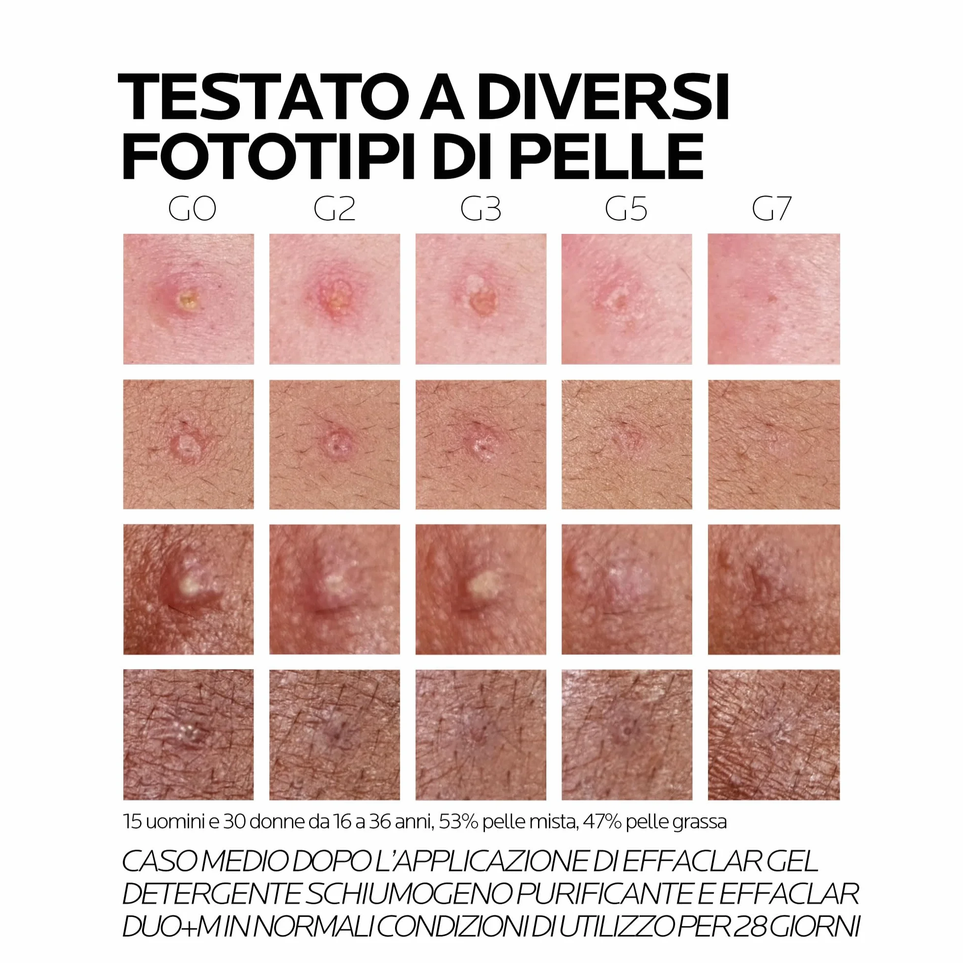 La Roche Posay Effaclar Duo + M Trattamento Tripla Correzione Anti-Imperfezioni 40 ml