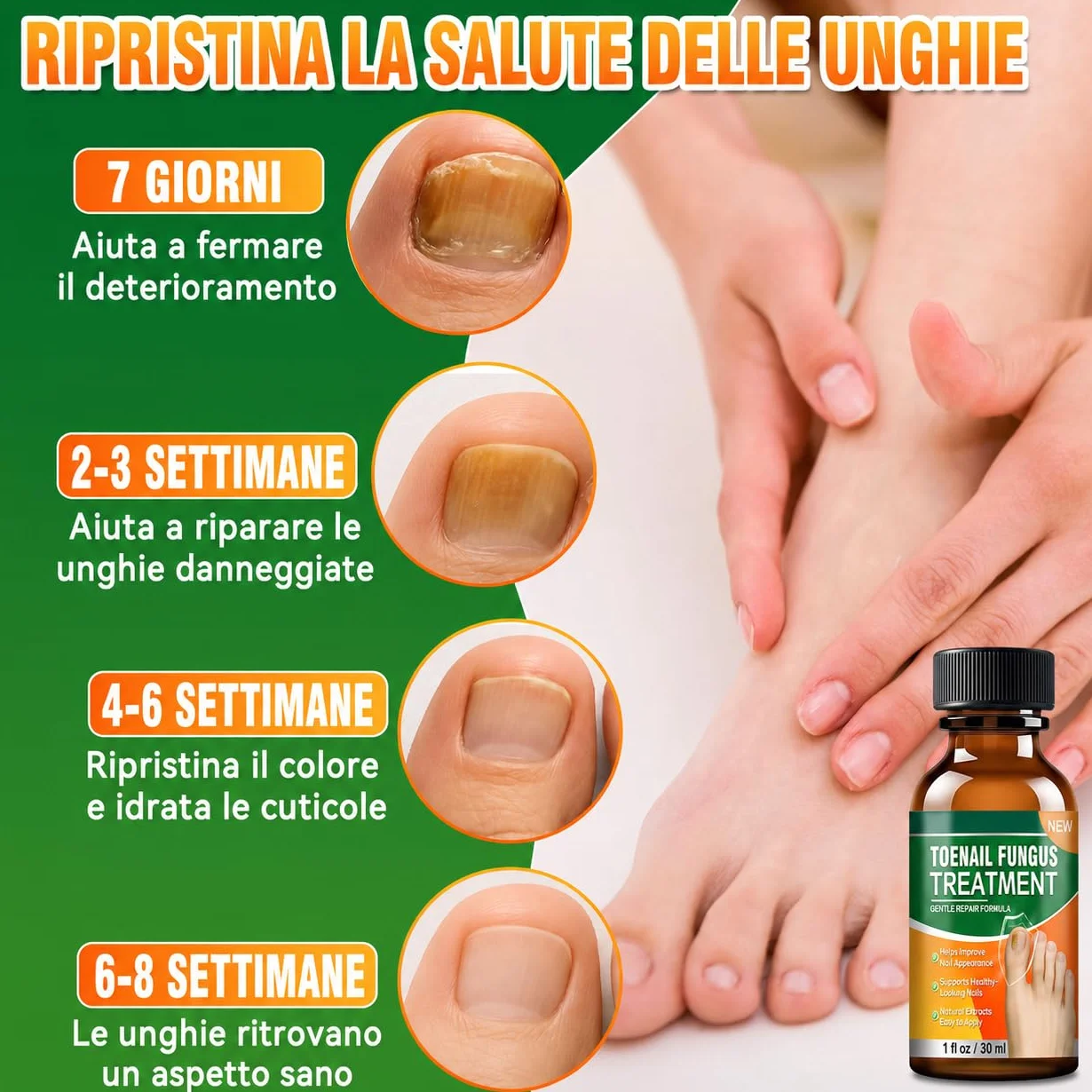 Micosi Unghie Piede Trattamento, Trattamento Funghi Unghie Piedi, Antimicotico Unghie Piedi Liquido, Migliora Unghie Spesse, Fragili, Rotte e Scolorite, Trattamento Rigenerante per Crescita Unghie