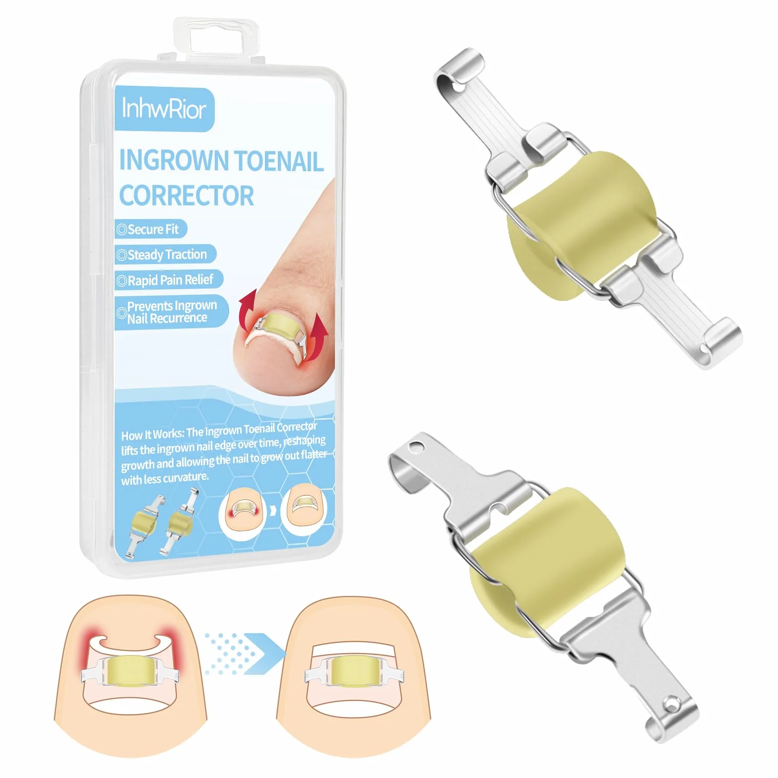 InhwRior Correttore per unghie incarnite, facile da usare a casa, stabile e sicuro, senza scivolamento, trazione continua per un sollievo rapido dal dolore, impermeabile per la doccia (19mm-21mm)