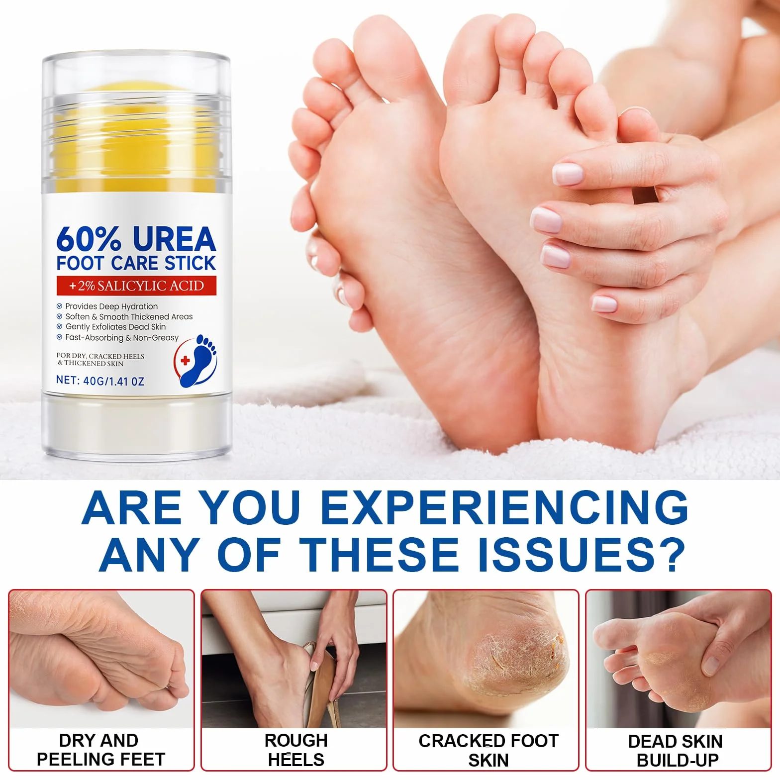 Crema all'urea al 60% per Piedi, Mani, Gomiti e Ginocchia - Riparazione Intensiva per Pelle Secca, Ruvida e Screpolata