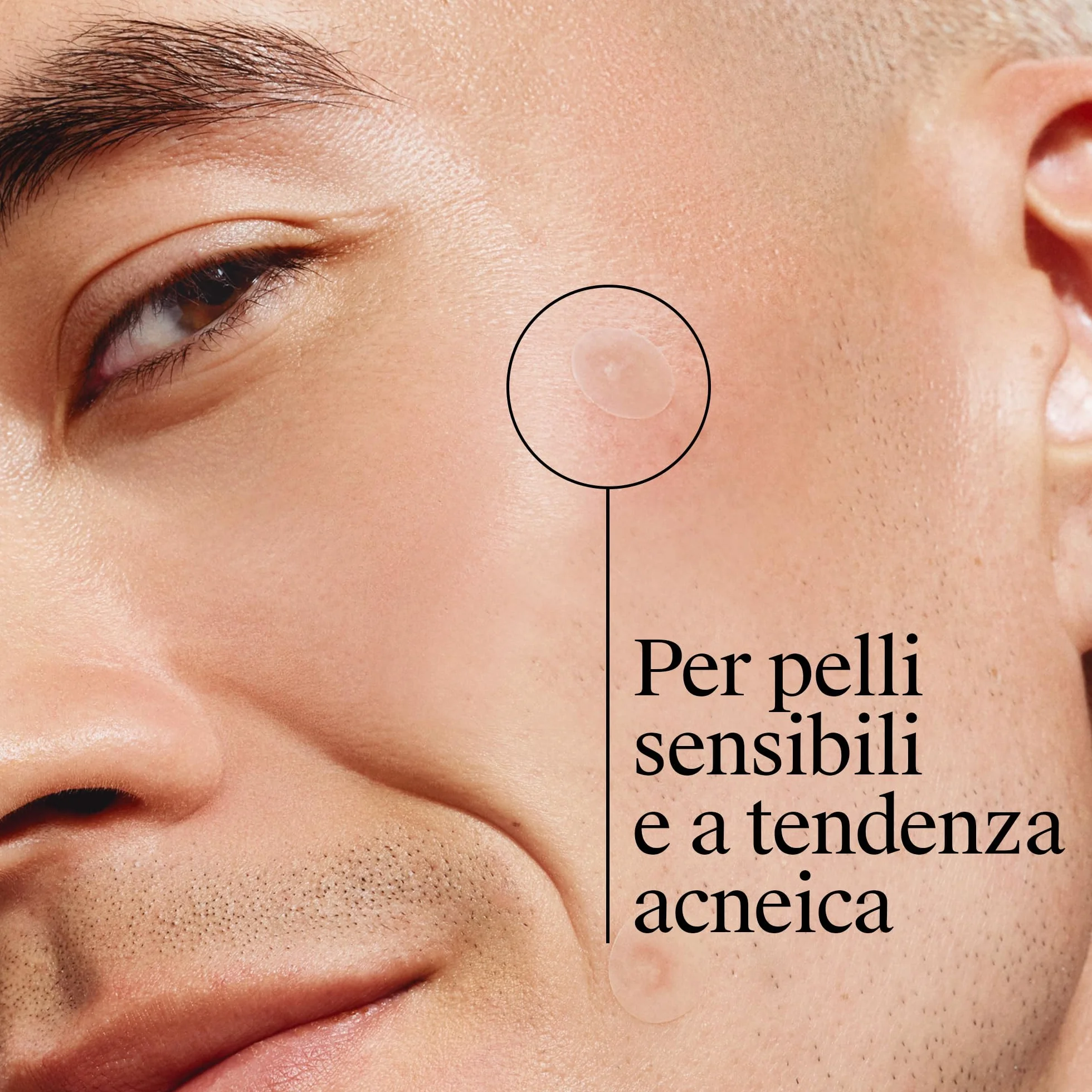 Neutrogena Clear & Defend+ Cerotti per Imperfezioni 30 pezzi, Patch brufoli idrocolloidali anti-imperfezioni, Cerotti brufoli per tutti i tipi di pelle, Pimple patches anti-acne delicati