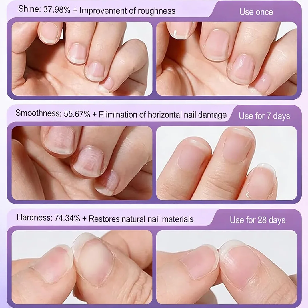 3 Pezzi Olio Cuticole Unghie, Penna per Olio Set di Oli per Cuticole, Trattamento delle Unghie, Nail Moisturizer, Nail Care Pen Formula Non Grassa