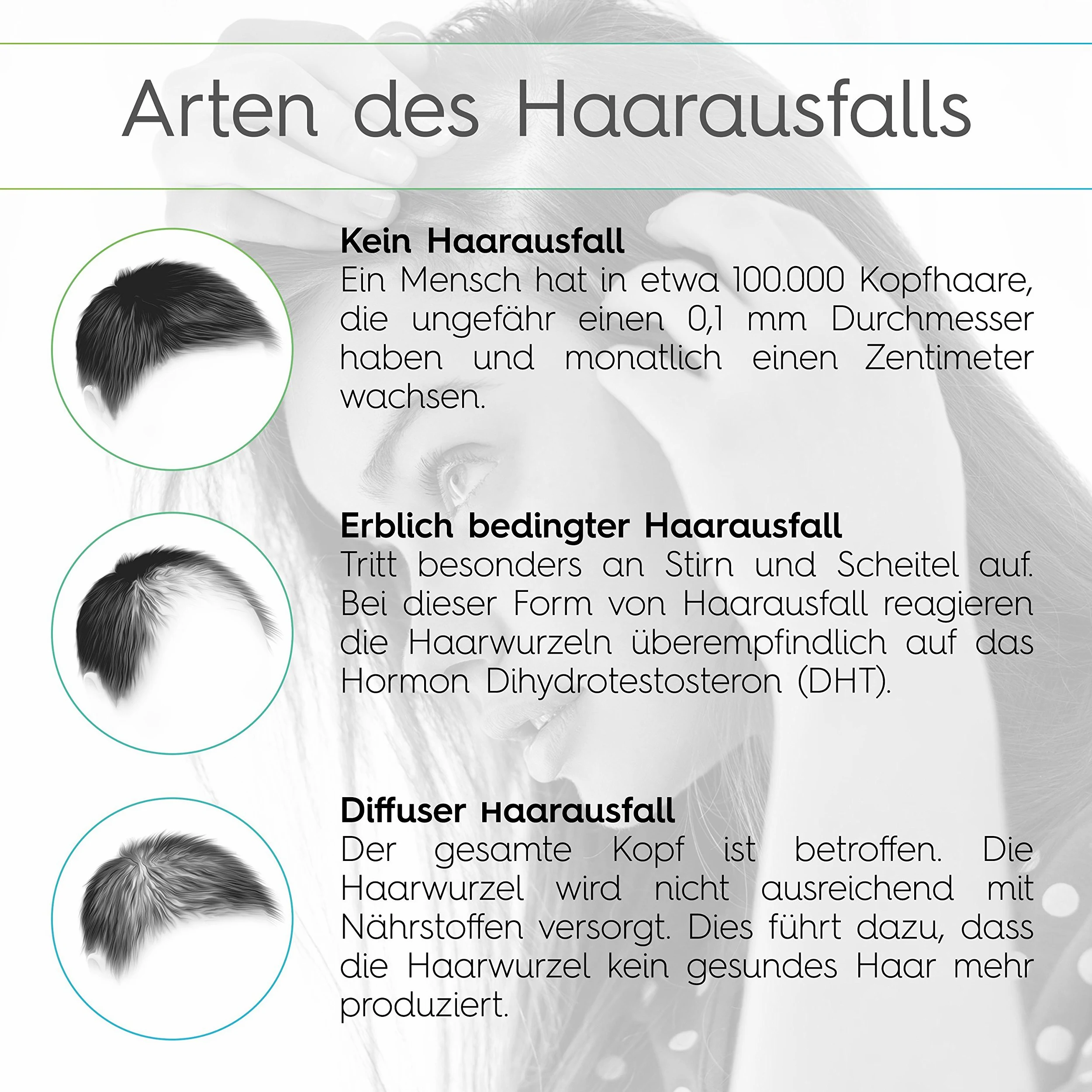 Vitabay Hair Growth Solution 70 ml • Siero contro la Perdita dei Capelli | Ispessimento e Crescita dei Capelli • Anticaduta Capelli Uomo e Donna