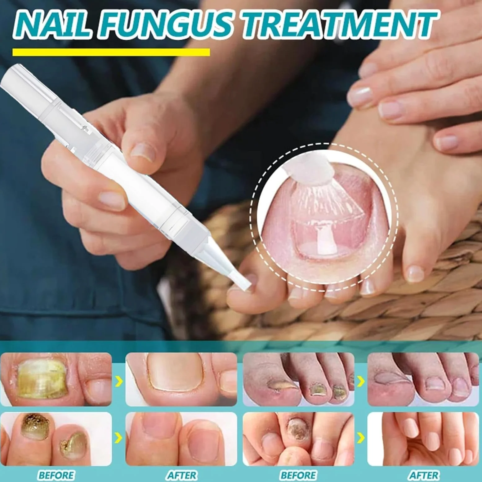Penna per la cura delle unghie, illumina la superficie del rimuovi cuticole, olio 3 in 1 per unghie secche e danneggiate, amplificatore idratante per unghie sospese, portatile (14 pezzi)