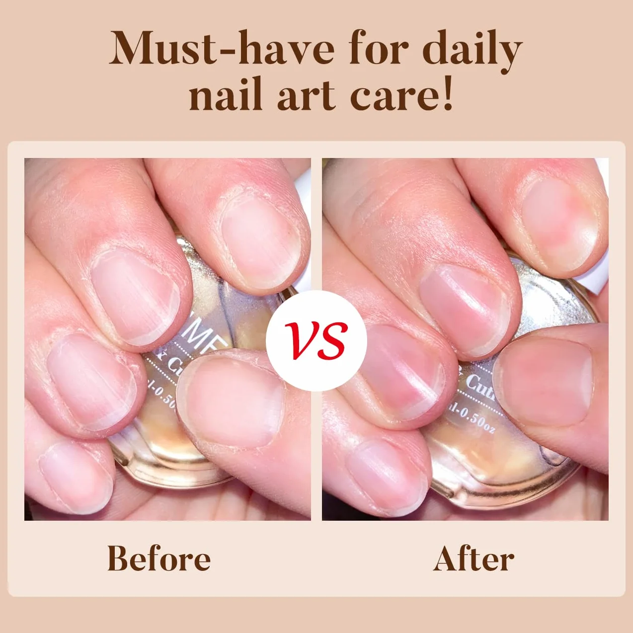 AIMEILI Olio per Unghie e Cuticole Nail Cuticle Replenishing Nutrizione Oil, Trattamento Delle Unghie Cuticola Revitalizer Olio Nail Polish Nutrire La Pelle Protezione 15ML