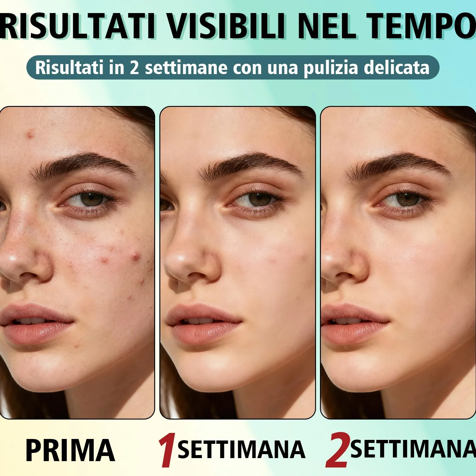 Crema Brufoli Viso, Crema Acne Potentissima, Cura per Brufoli e Imperfezioni, Riduce Subito Acne e Brufoli, Punti Neri e Rossori, Adatta a Tutti i Tipi di Pelle e Età,per la Pelle di Viso e Corpo