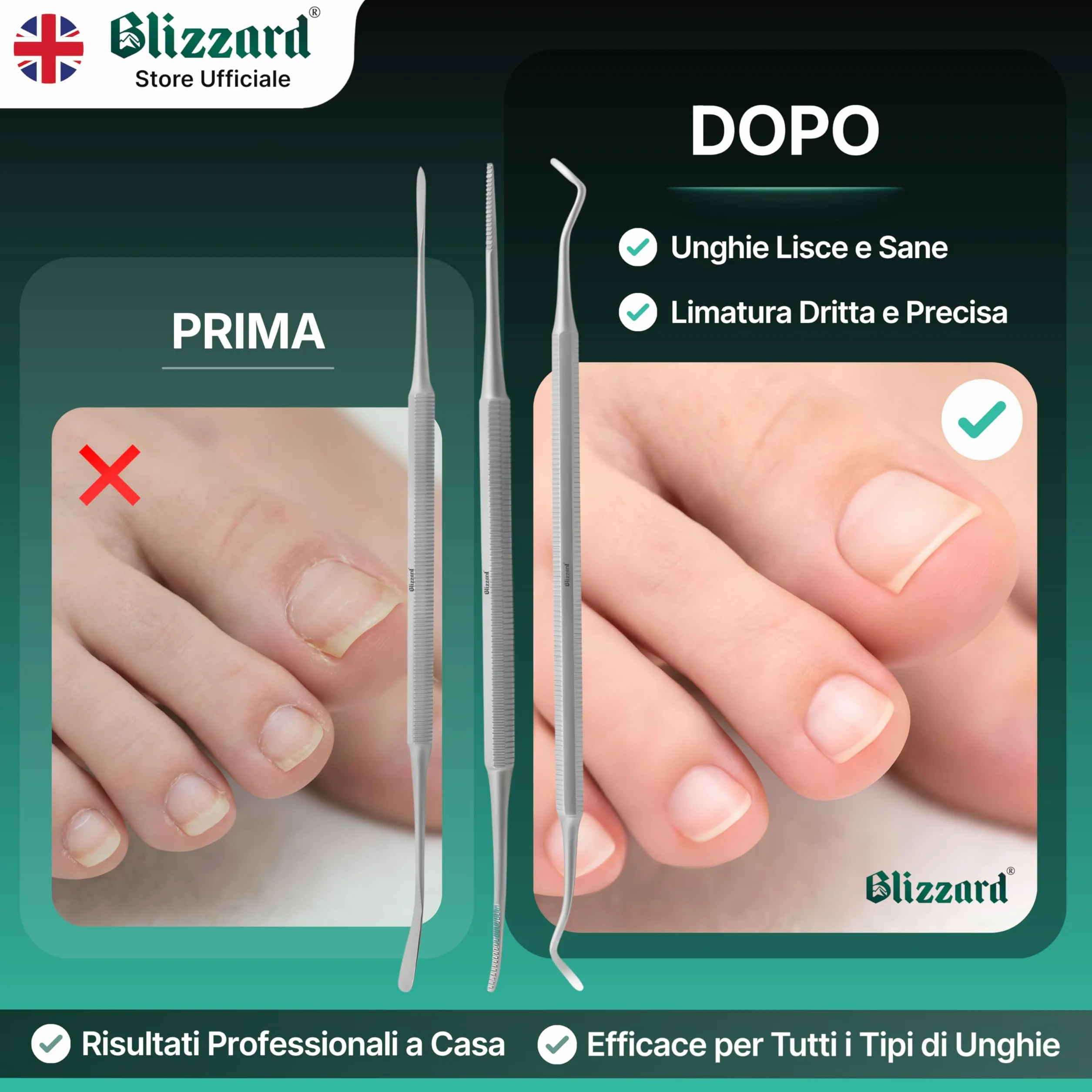Blizzard Kit Pedicure Professionale 3 Pezzi Ferri da Podologo per Unghie Incarnite Acciaio Inox