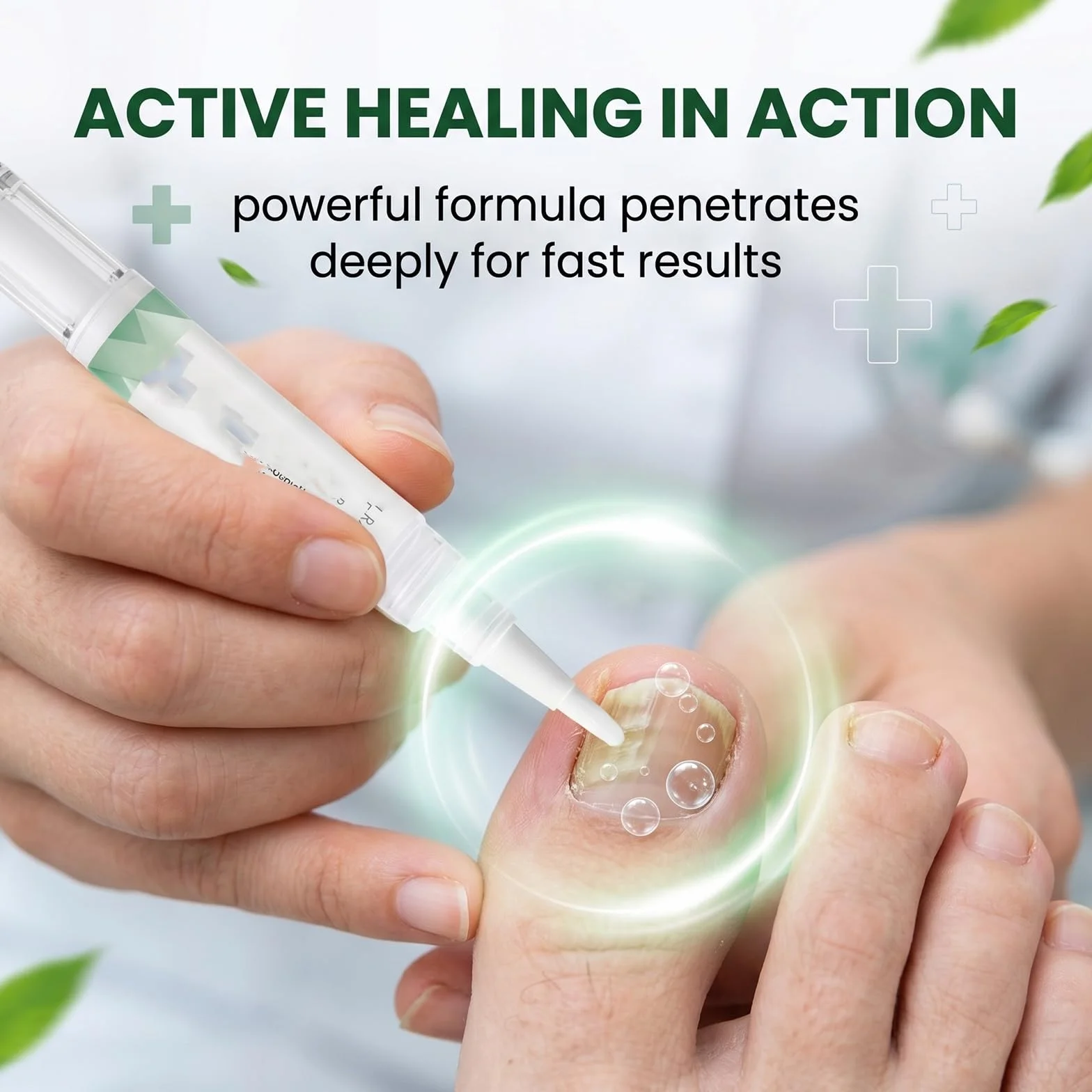 2 Pezzi Nail Care Pen per Micosi Unghie Piedi e Mani, Penna per Trattamento Unghie Danneggiate e Fragili, Soluzione per la Cura e Rigenerazione delle Unghie, 2 x 5g