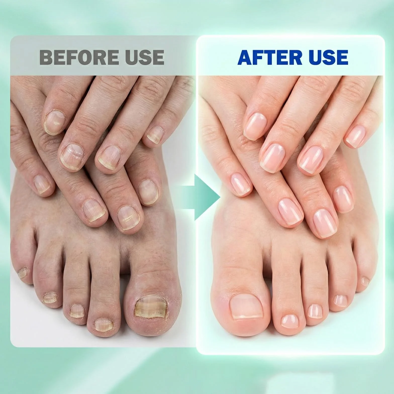 21 Pezzi Fungal Nail Patches con 1 Cuscinetto Antiusura, Cerotti per Micosi Delle Unghie, Micosi Unghie Piede
