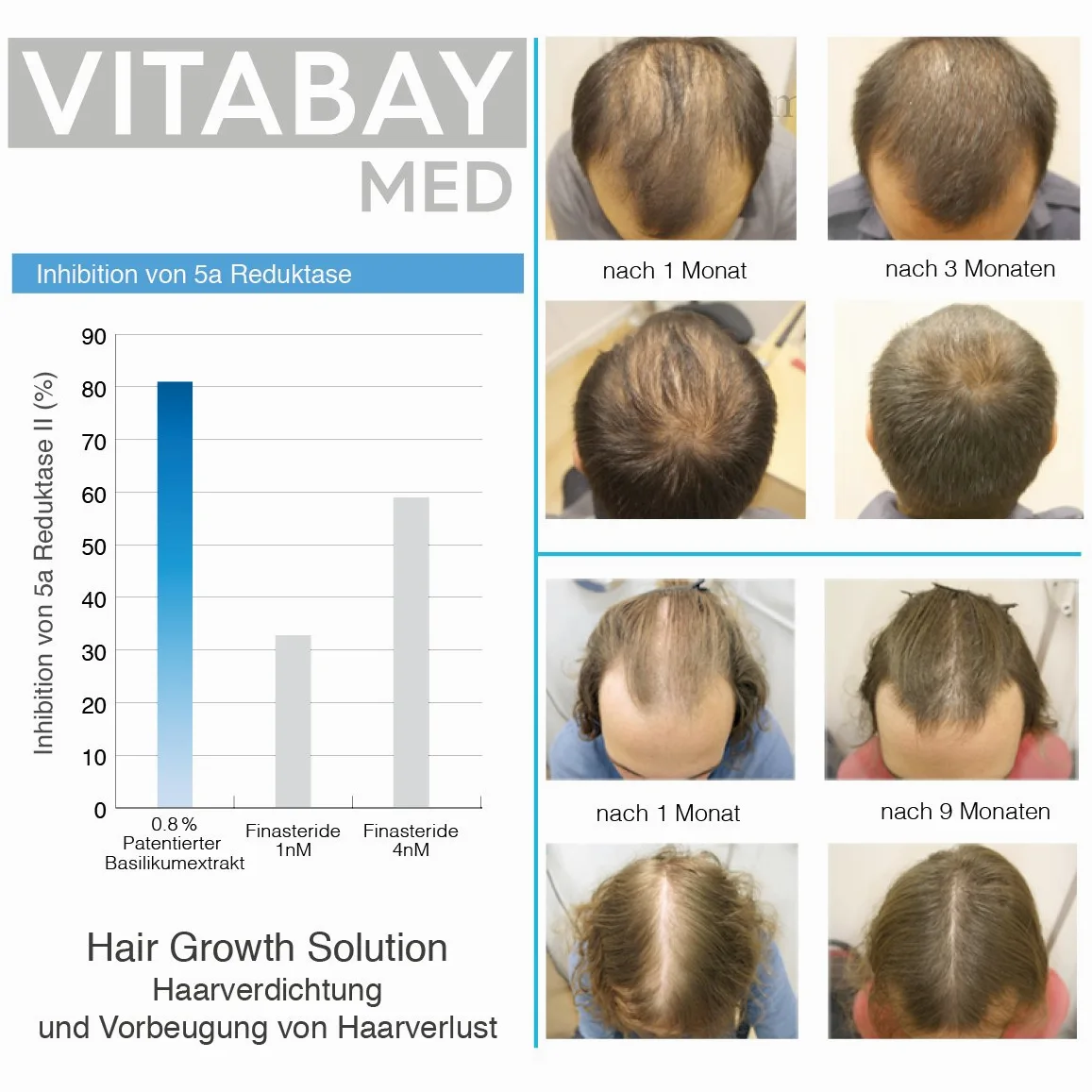Vitabay Hair Growth Solution 70 ml • Siero contro la Perdita dei Capelli | Ispessimento e Crescita dei Capelli • Anticaduta Capelli Uomo e Donna