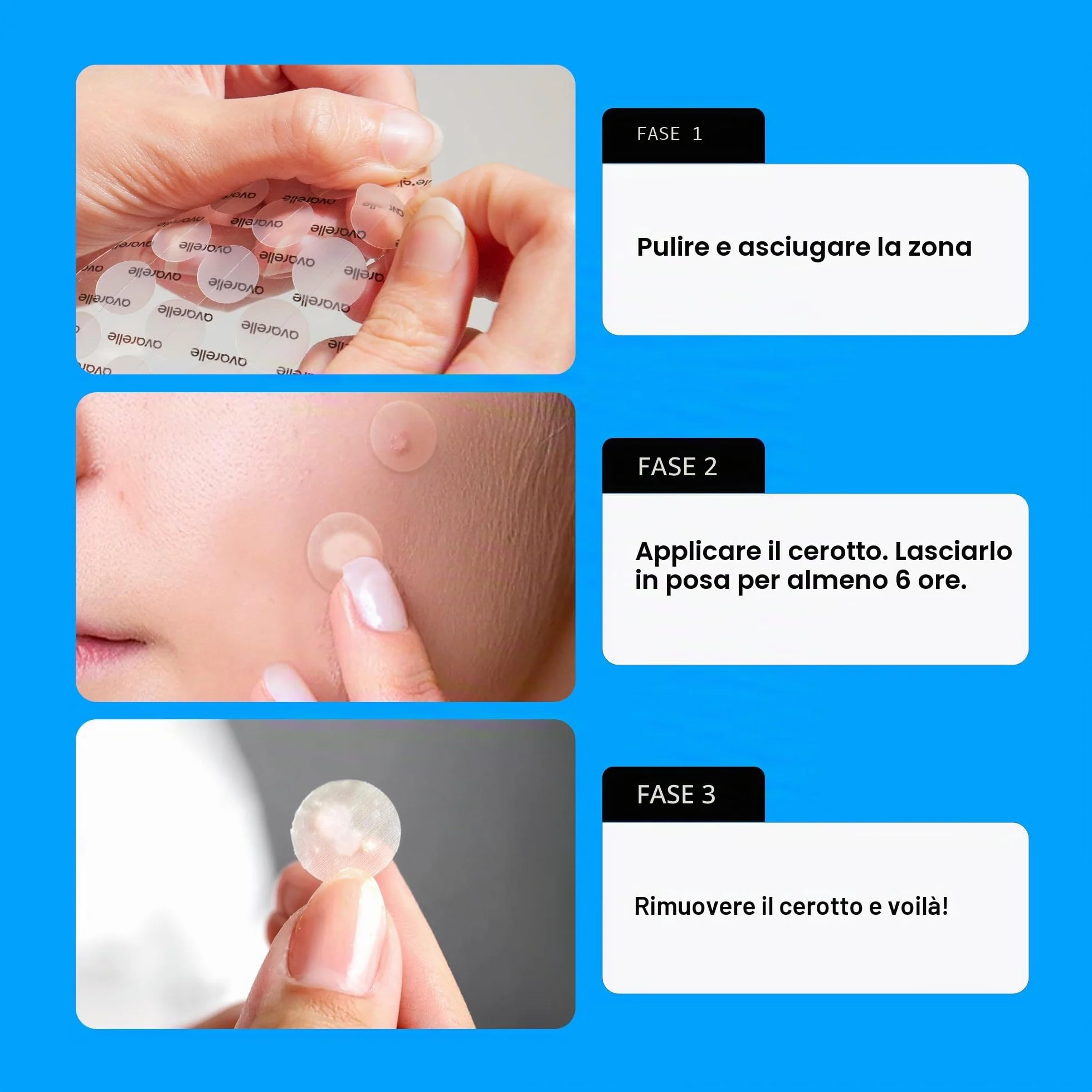 AVARELLE Pimple Patches: Cerotti brufoli viso Hydrocolloidali con Olio di Tea Tree, Anti-acne, Vegan e Cruelty-free, ideali per trattamento mirato di brufoli e imperfezioni, skincare coreana