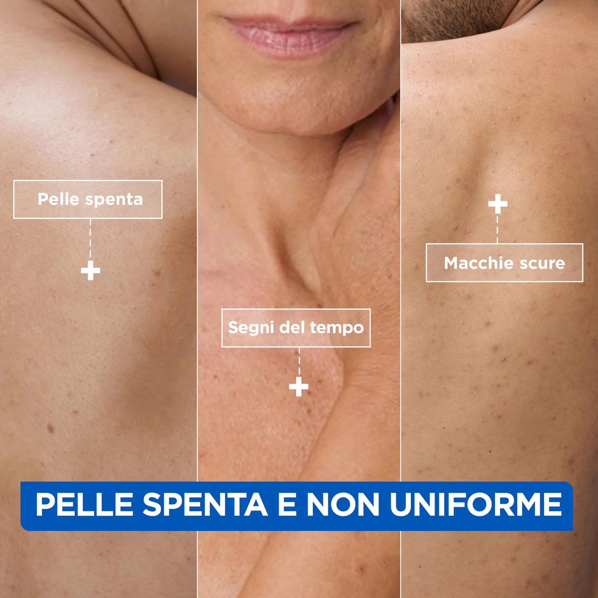 Mixa Crema Idratante Anti-Macchie Niacinamide 9% Vitamina C Burro di Karité 400 ml