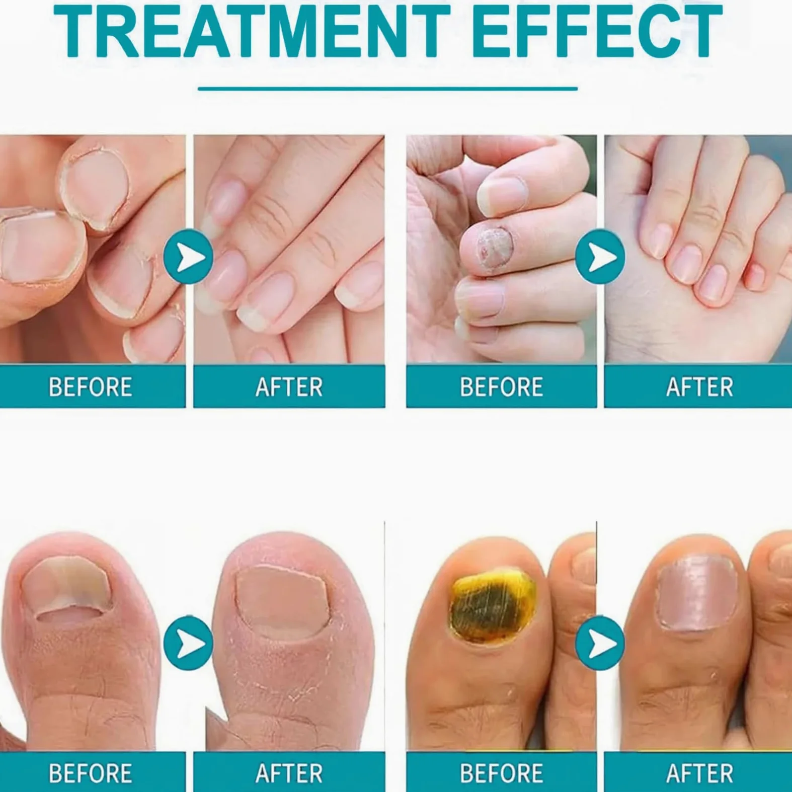 Penna per la cura delle unghie, illumina la superficie del rimuovi cuticole, olio 3 in 1 per unghie secche e danneggiate, amplificatore idratante per unghie sospese, portatile (14 pezzi)