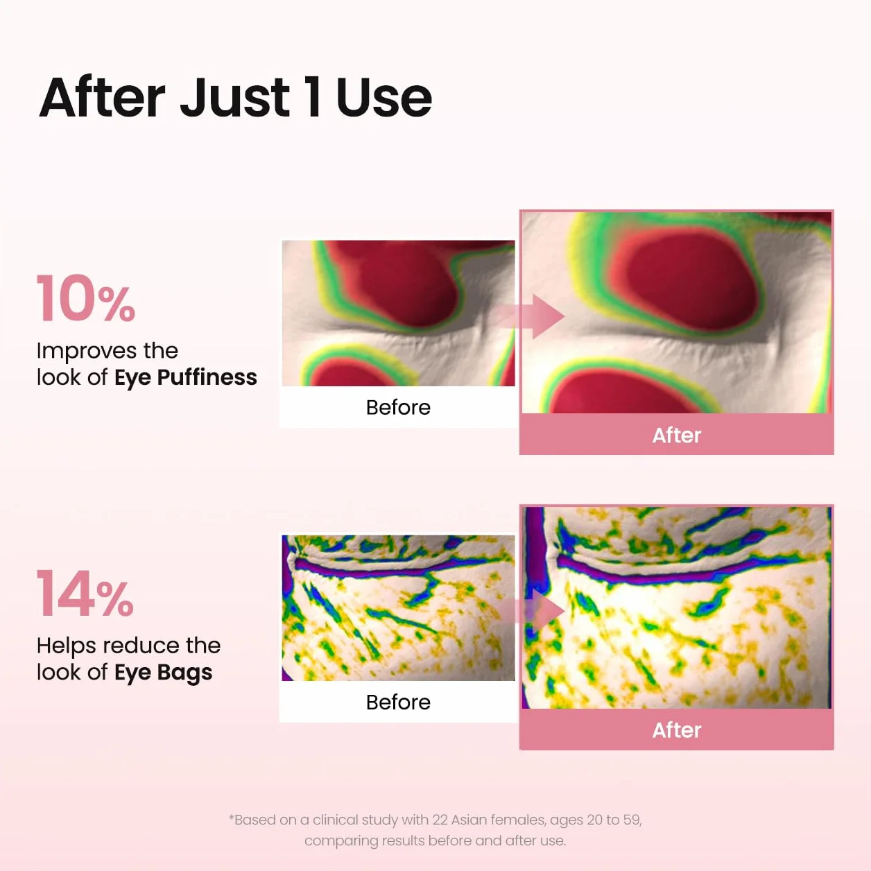 BIODANCE Patch Occhi al Collagene e Peptidi, Trattamento Antirughe per Contorno Occhi e Linee del Sorriso, Maschera Occhi per Linee Sottili e Borse, Skincare Coreana (60 pezzi)