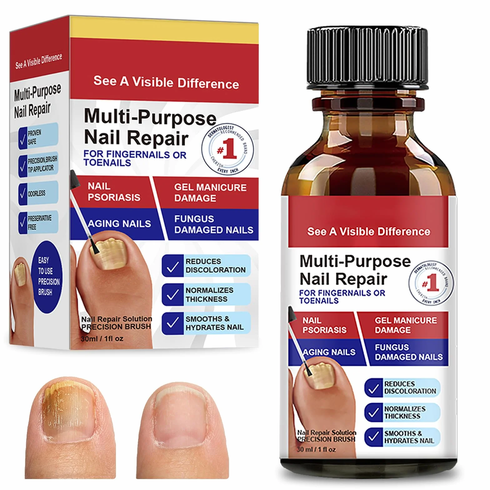 30ml Riparazione Unghie,Soluzione per la Cura delle Unghie,Liquido Cura unghia,per Migliorare l'Aspetto delle Unghies e Rinforzare la Struttura dell'Unghia,Uso Quotidiano