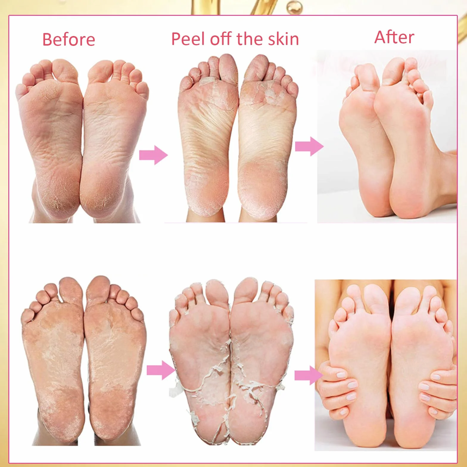 Maschere Idratanti per Piedi, 7 Paia Maschera Idratante per la Cura dei Piedi, Maschera Piedi Peeling Esfoliante, Maschera Idratante per Peeling Piedi, Calzini Esfolianti per Piedi per Donne Uomini
