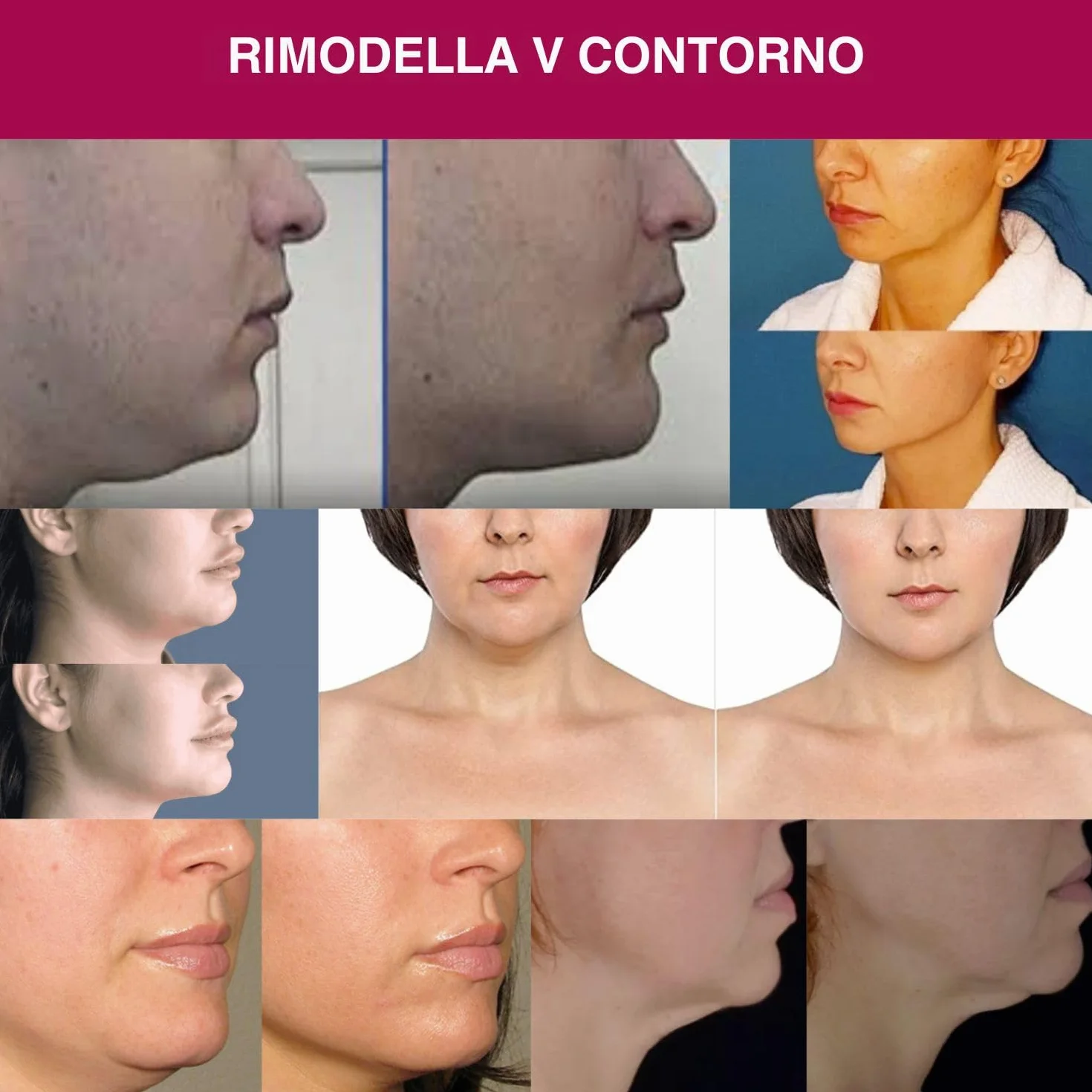 Crema Collo Avanzata - Crema Antietà Collo Mento E Mascella Per Donne E Uomini 30 ml