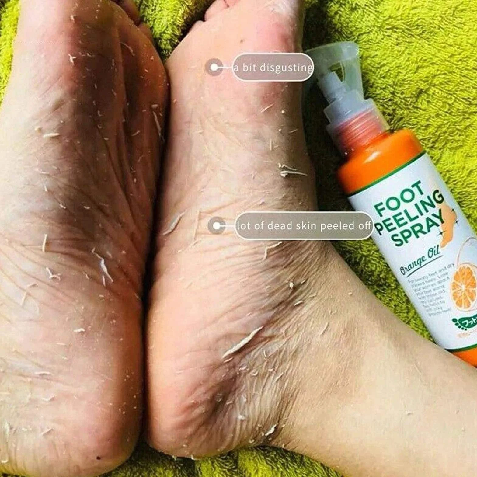 Foot Peeling Spray Orange Oil, Foot Peeling Spray That Remove Dead Skin, Hydrating Nourish Peel Off Spray, Remove Dead Skin within Seconds, Exfoliating Peeling & Calluses on Feet