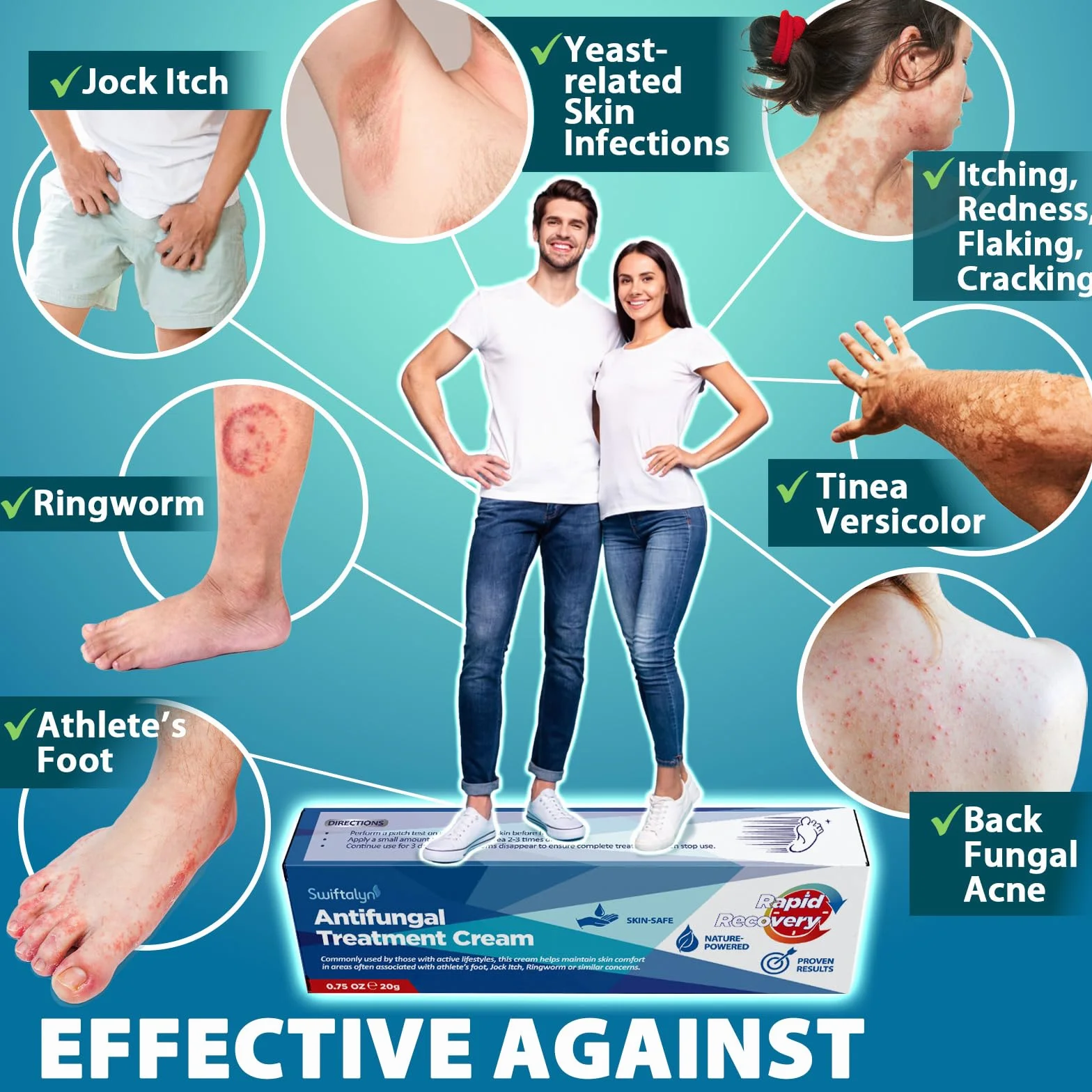 Crema antimicotica per piedi e pelle: uso quotidiano per la pelle soggetta a piede d’atleta, funghi cutanei e micosi inguinale – formula naturale per uomo e donna, 20 g