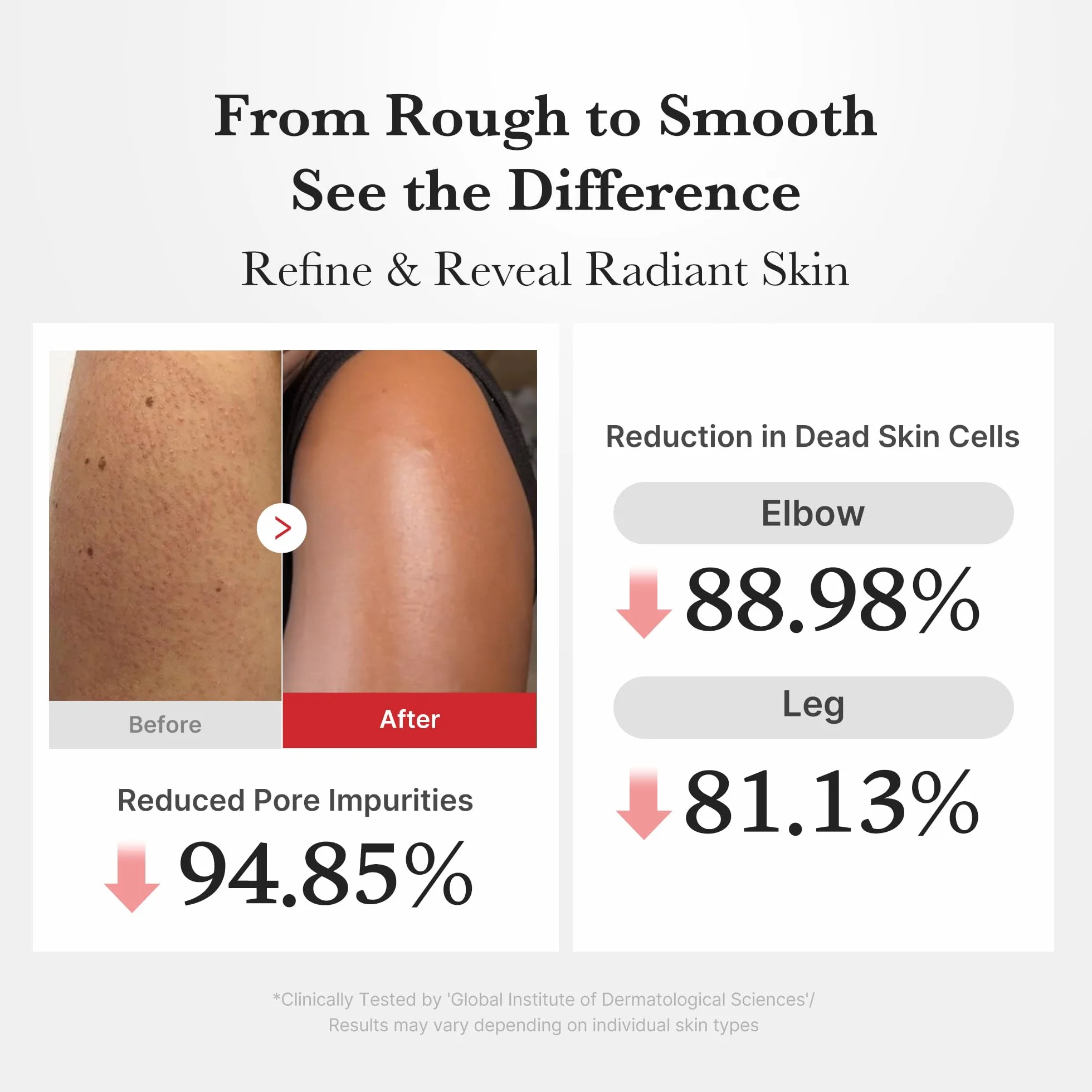 Medicube Body Peel Shot Hypochlorous Acid Gentle Exfoliating Serum Dead Skin Cells Rough Patches Uneven Texture Rice Extract Panthenol Hydrating Smoothing 9.46 fl.oz