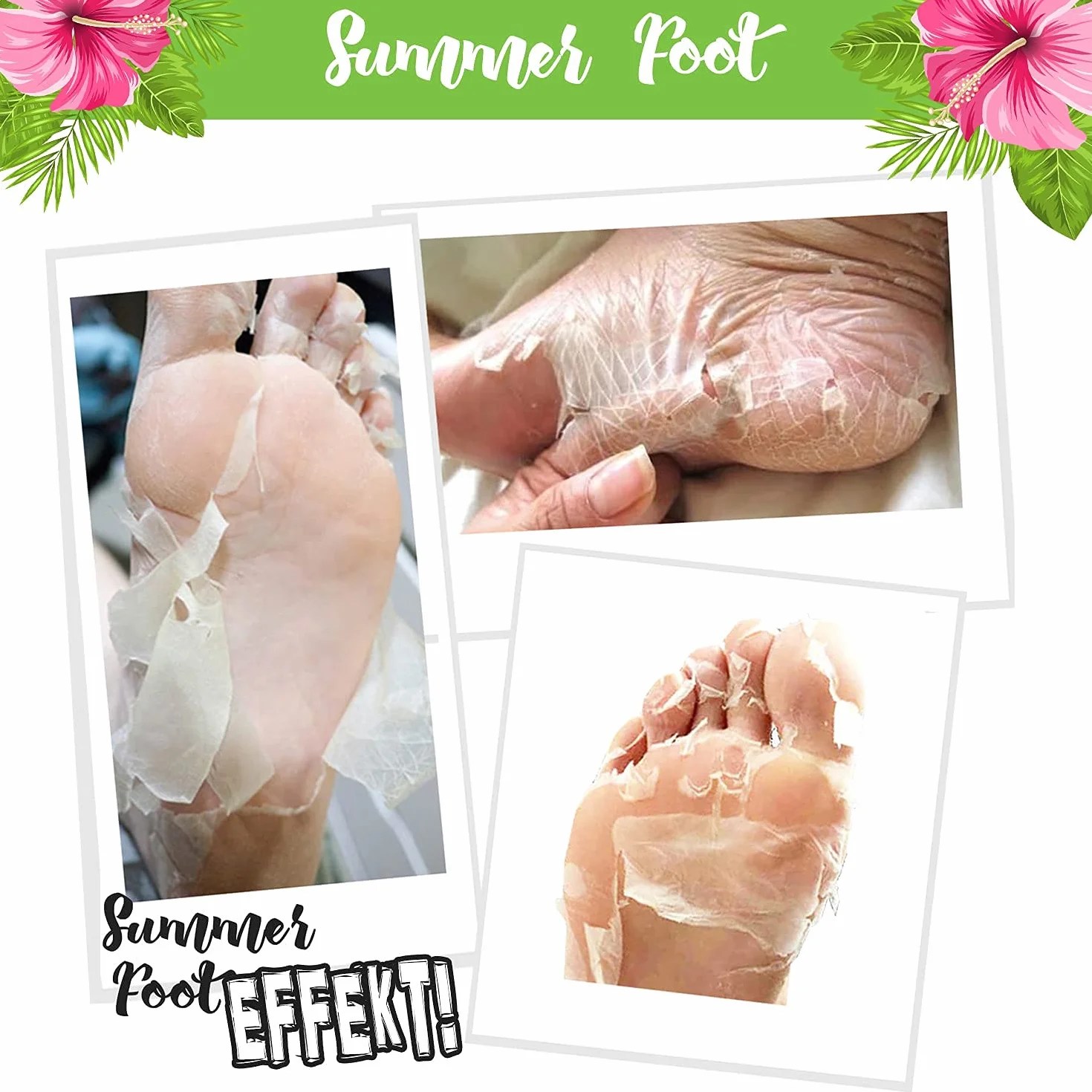 SUMMER FOOT Premium - Maschera per la rimozione di calli I dermatologicamente testata, istruzioni in lingua tedesca (Green Edition)