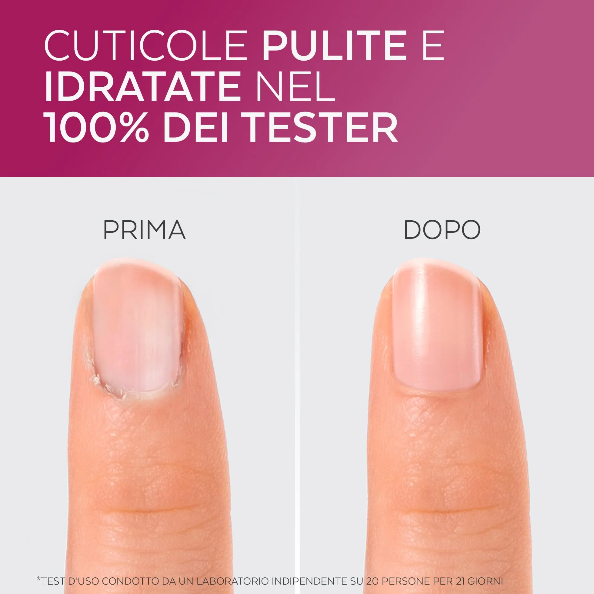 Cuticole Remover 2-in-1 - Rimuove Pelle Morta - Swiss Lab