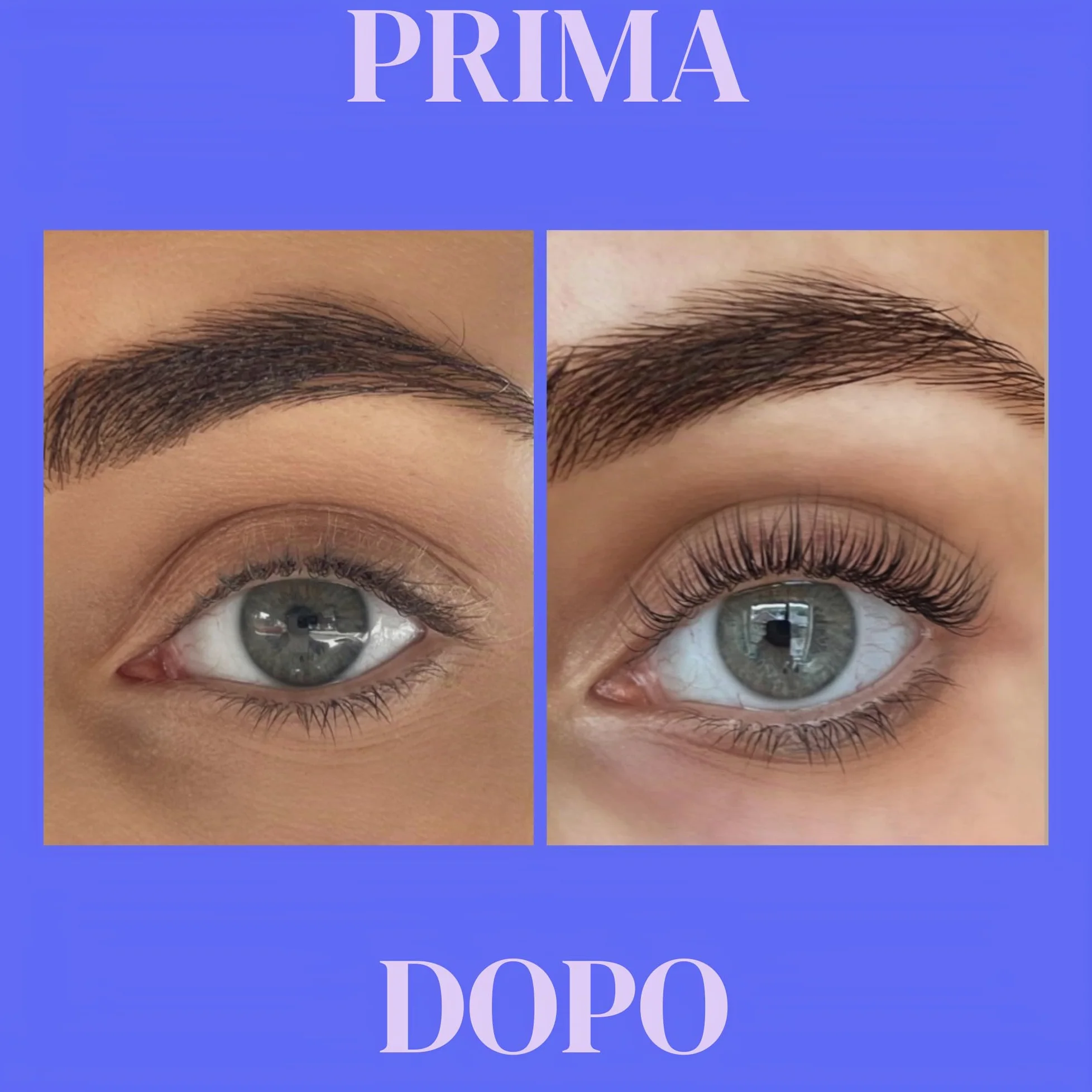 Xlash Eyelash Siero 3Ml per la beauty routine quotidiana, per trattamento mirato e luminosità, 3ml