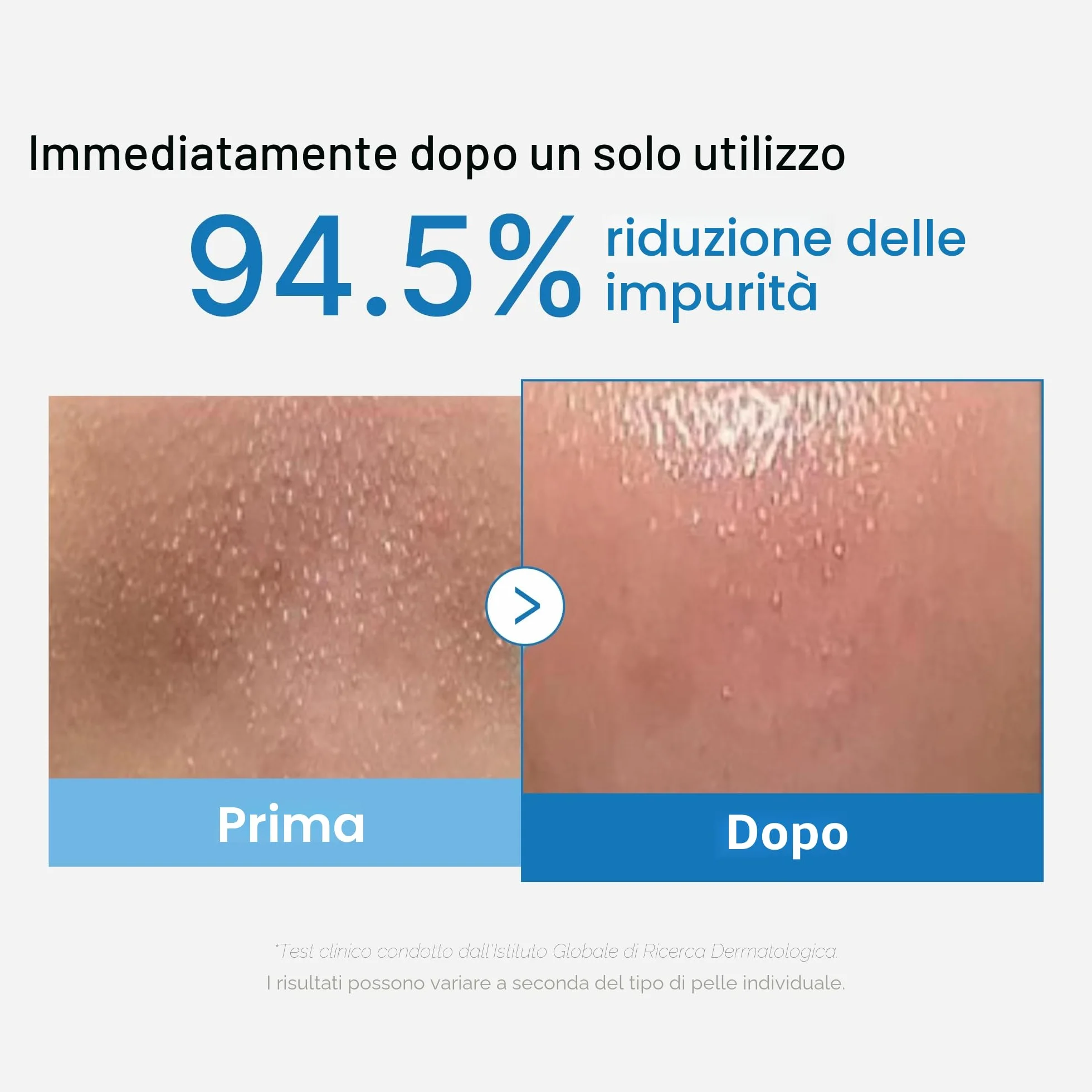 Medicube Zero Pore Olio Detergente Per Punti Neri 205 Ml Detergente Viso Idratante