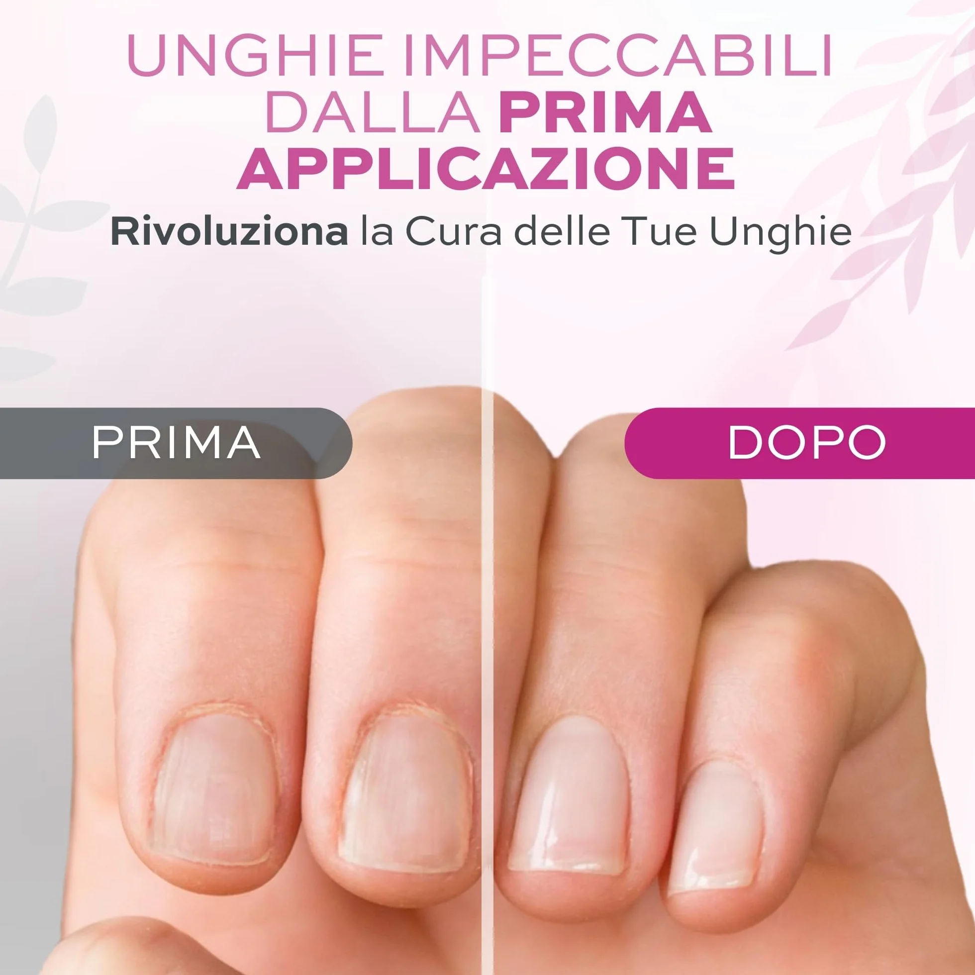 Rimuovi Cuticole Unghie di Mani e Piedi Professionale 12 ml - Scioglie e Rimuove Cuticole Trattamento per Unghie di Mani e Piedi