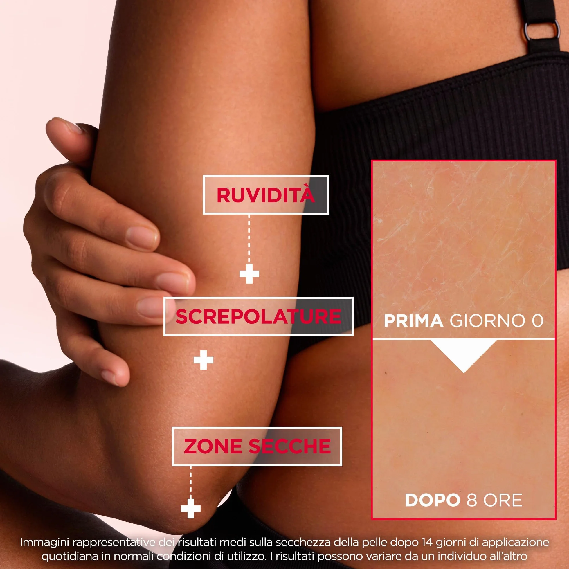 Mixa Crema Corpo Rigenerante 10% Urea Amino Acid 400 ml Pelle Secca Ruvida