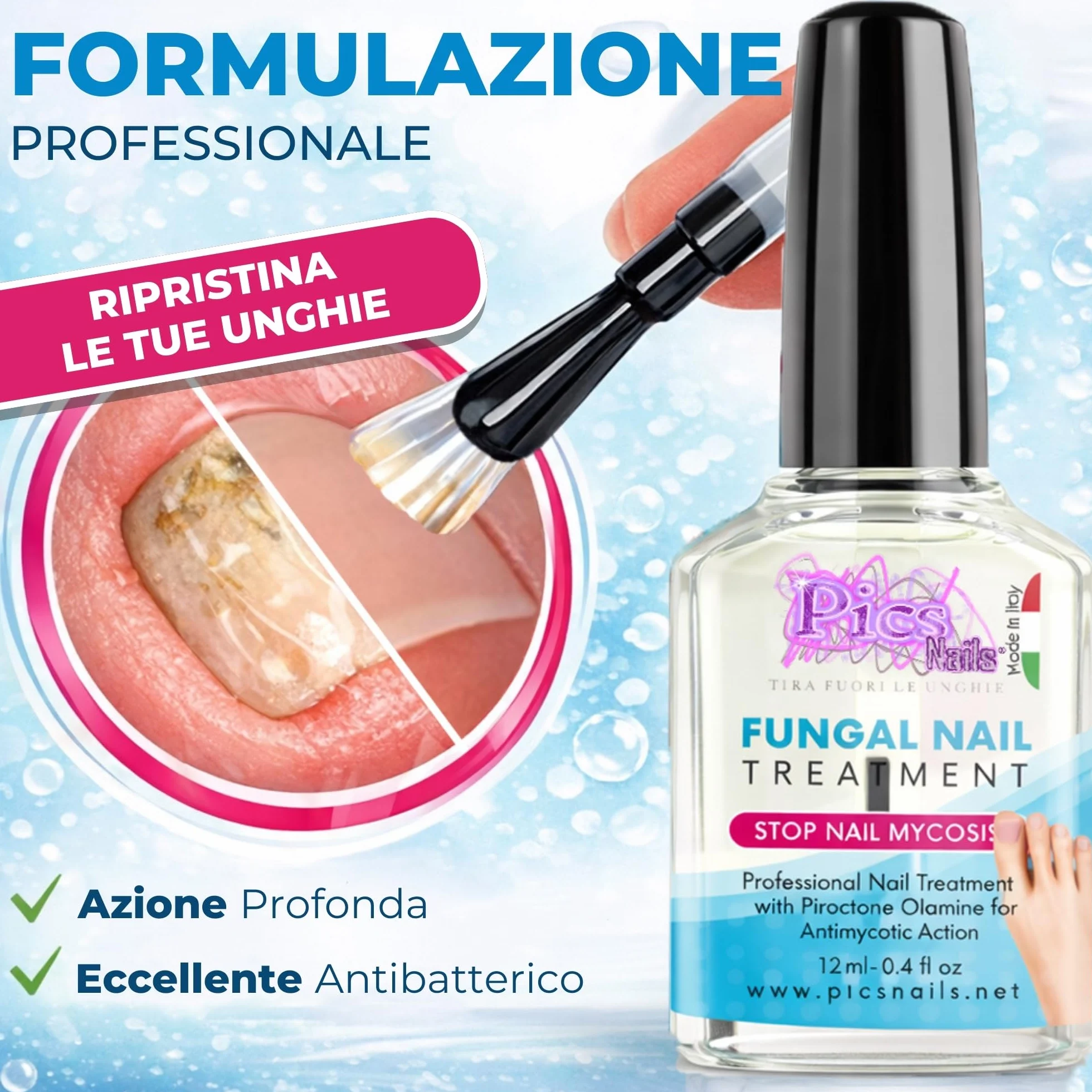 Antimicotico Micosi Unghie Piedi e Mani 12 ml - Trattamento Micosi del Piede e della Mano