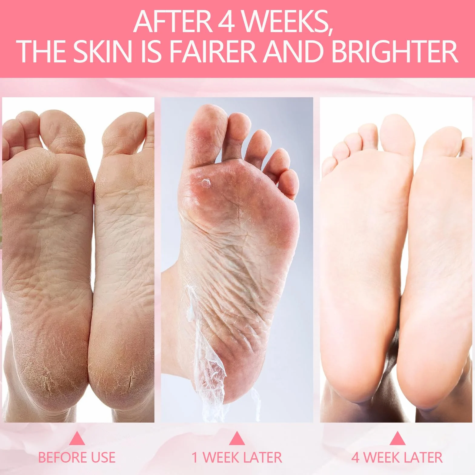 2 Paia Maschera Piedi Esfoliante, Trattamento Peeling Intenso, Peeling Delicato, Trattamento per Talloni Ruvidi, Pelle Liscia, Effetto Idratante Prolungato (Rosa/Aloe)
