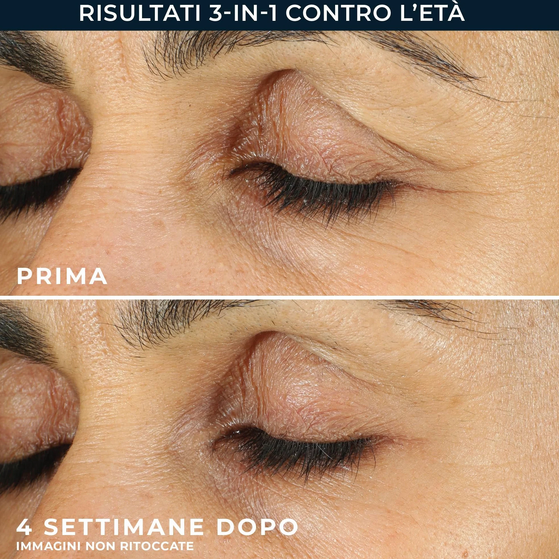 RoC - Retinol Correxion Line Smoothing Crema Contorno Occhi - Riduce Visibilmente Gonfiori e Occhiaie - Antirughe e Antietà - 15 ml