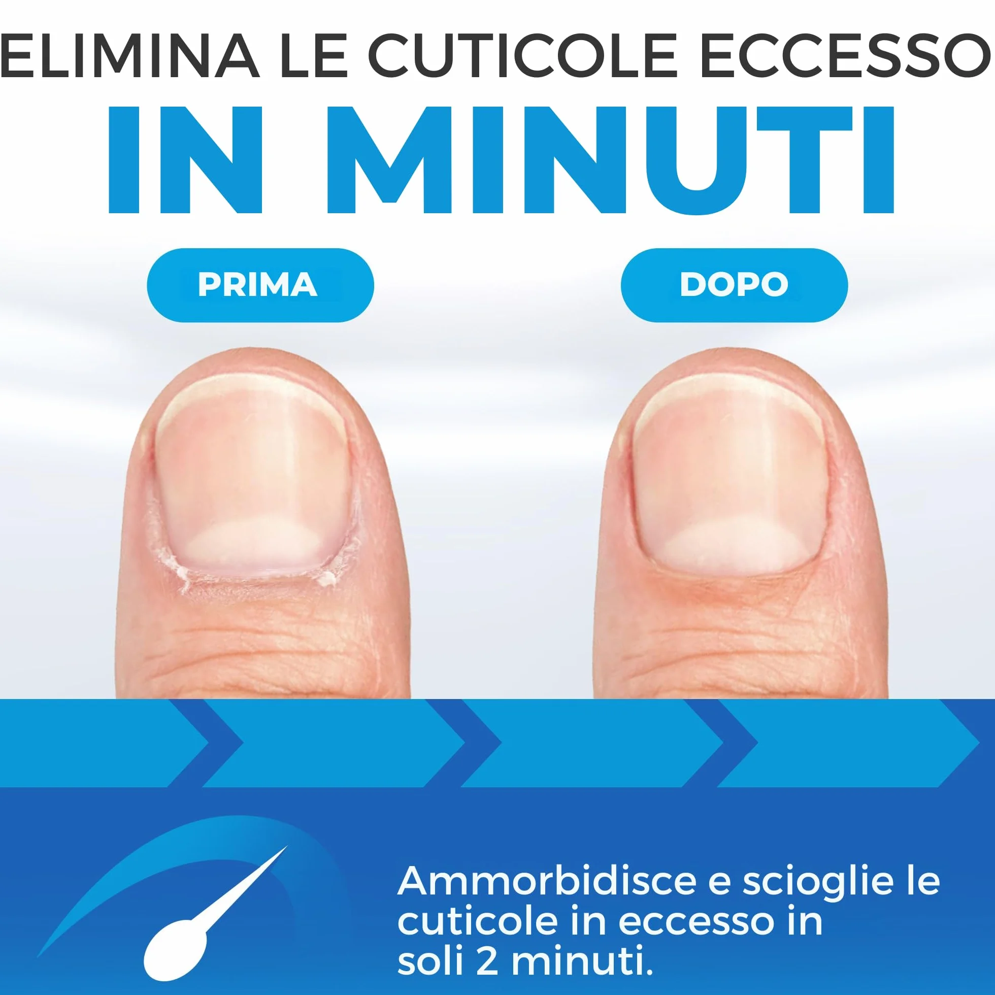 Imperial Feet Rimuovi Cuticole Liquido-150ml Formula Professionale | Rimozione Istantanea della Cuticola con Glicerina e Urea-Detergente per Unghie che Ammorbidisce e Scioglie le Cuticole in Eccesso
