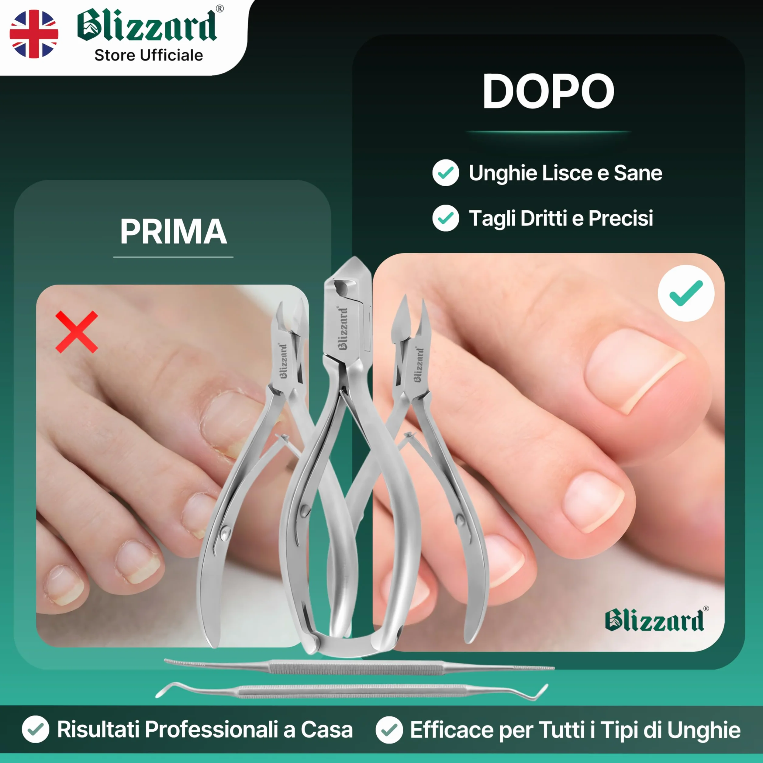 Blizzard Set Podologia 5 Pezzi Acciaio Inox - Kit Pedicure Unghie Spesse e Incarnite