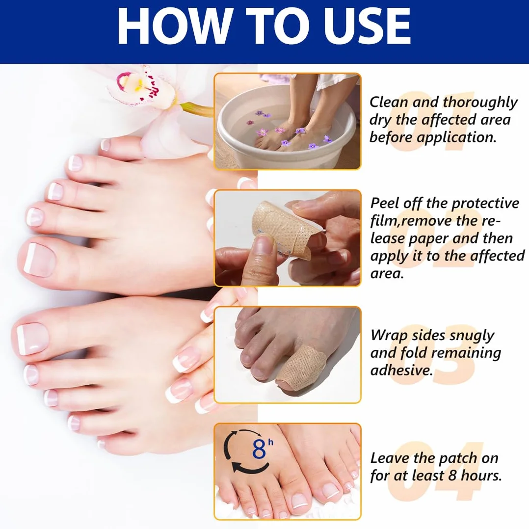 GXGM 32 Pezzi Funghi Unghie Piedi Patch per la Riparazione Delle,Applicabile per Riparazione delle Unghie Divise,Trattamento Fungino Delle Unghie delle Punte,Riduce la Unghie Danneggiate