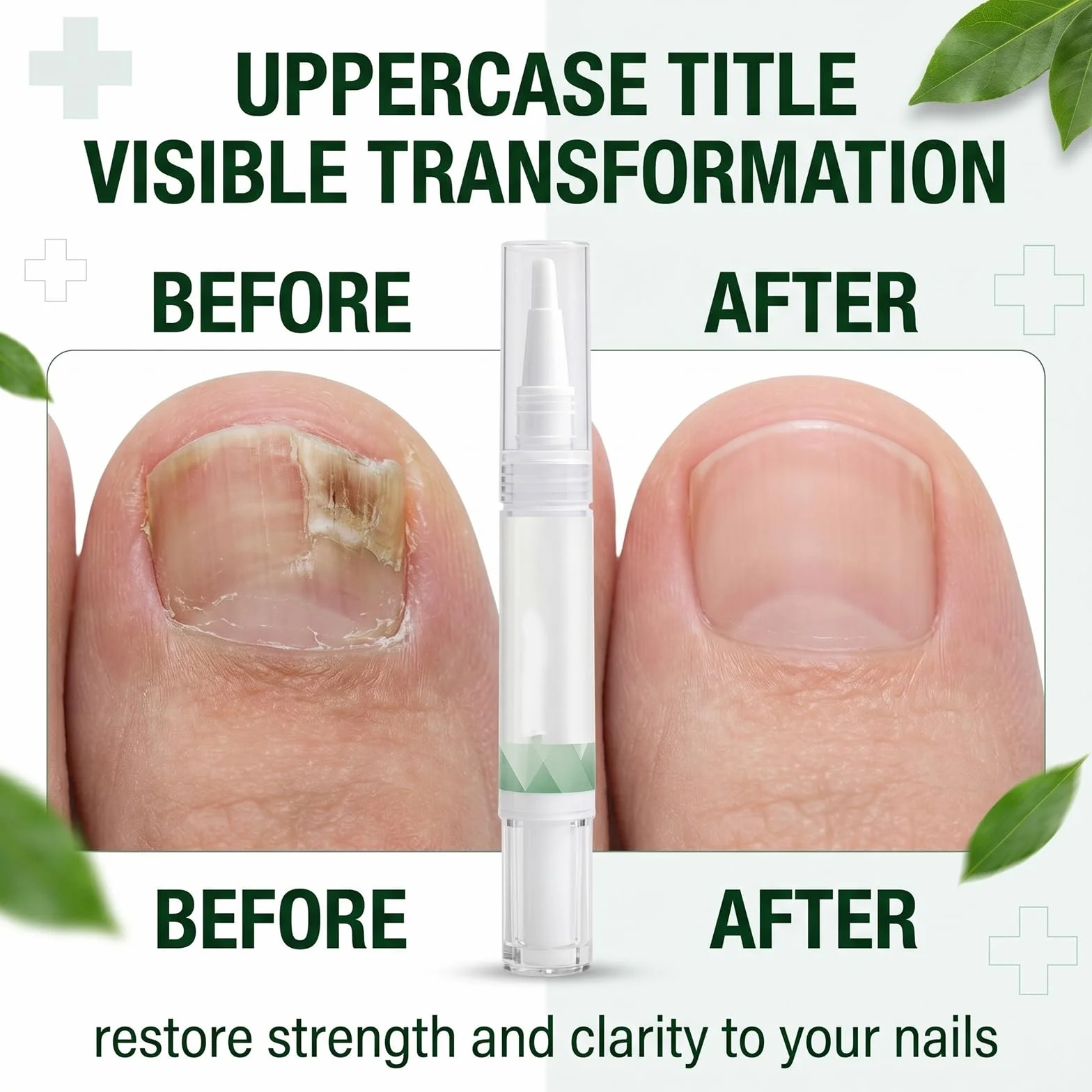2 Pezzi Nail Care Pen per Micosi Unghie Piedi e Mani, Penna per Trattamento Unghie Danneggiate e Fragili, Soluzione per la Cura e Rigenerazione delle Unghie, 2 x 5g