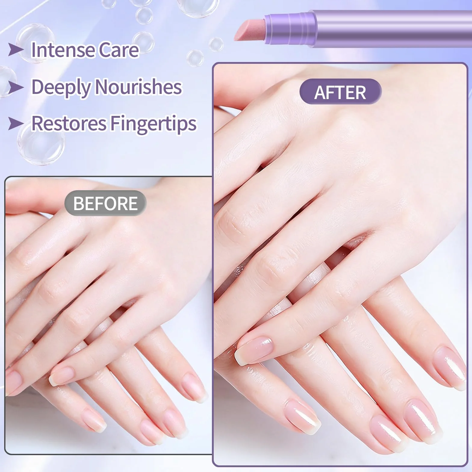 2 Pezzi Pennino 3 in 1 per la Cura di Cuticole e Unghie, Penne Liquide per Rimozione Cuticole, Penna Olio per Cuticole Unghie per Unghie Secche, Screpolate e Danneggiate