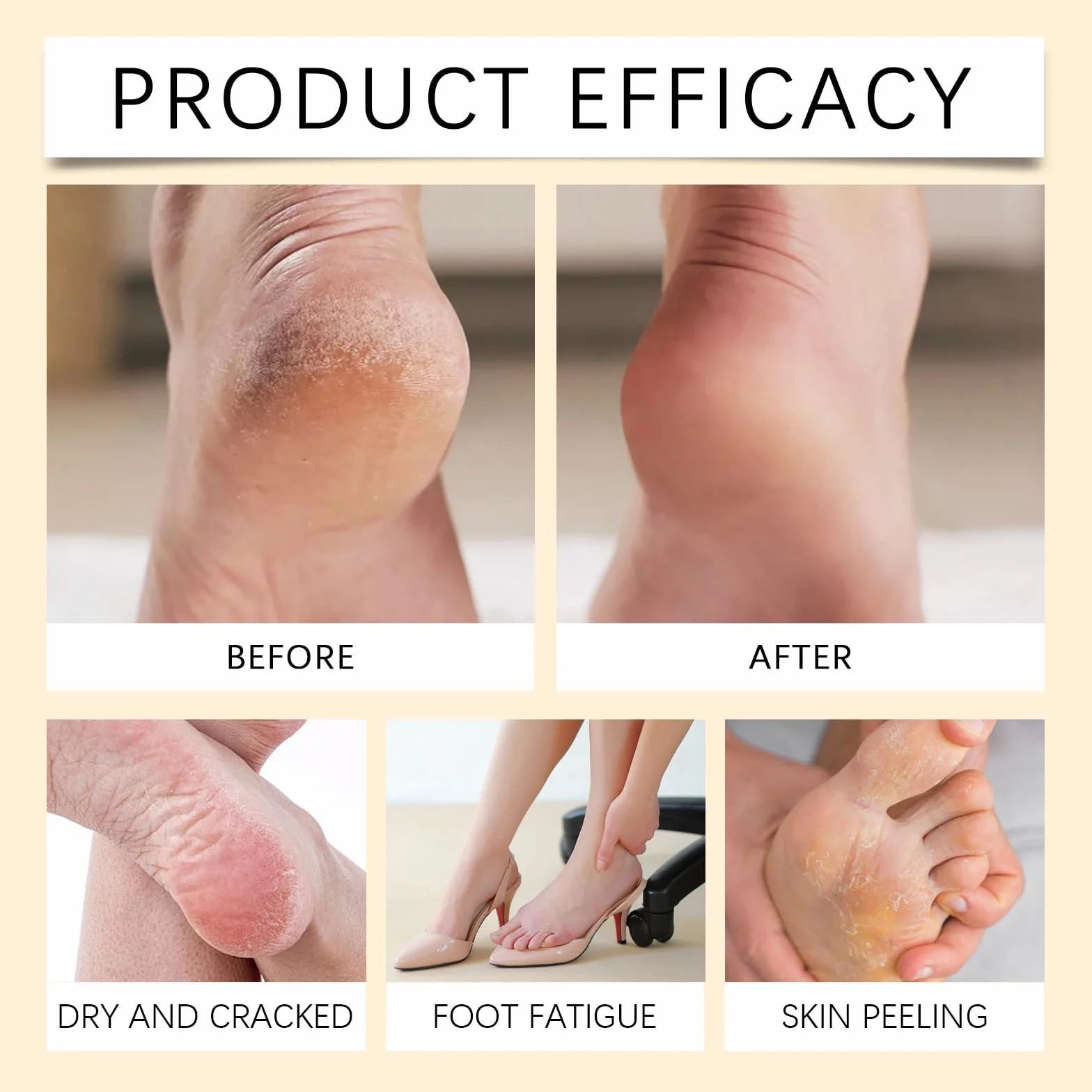 Spray Peeling per Calli e Idratante Nutriente Peel Off - Esfoliante Istantaneo per Piedi