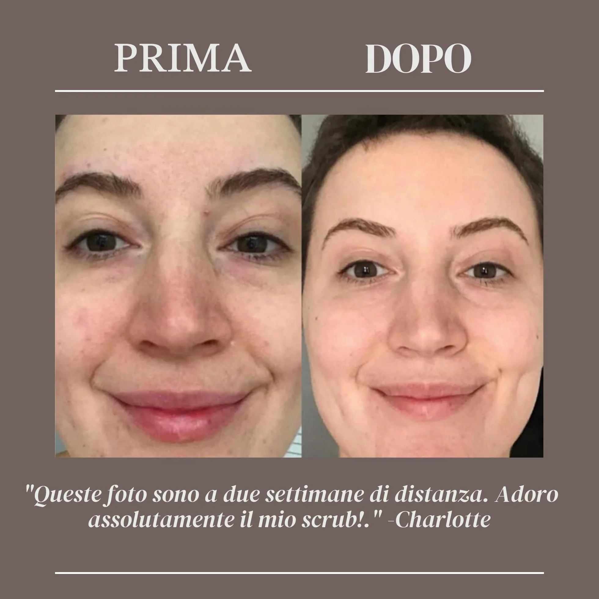 UpCircle Scrub viso al caffè - Miscela di agrumi per pelli normali e secche 100 ml - Burro di karité, cocco e olio di rosa canina - Esfoliante viso naturale e vegano per una pelle morbida e liscia