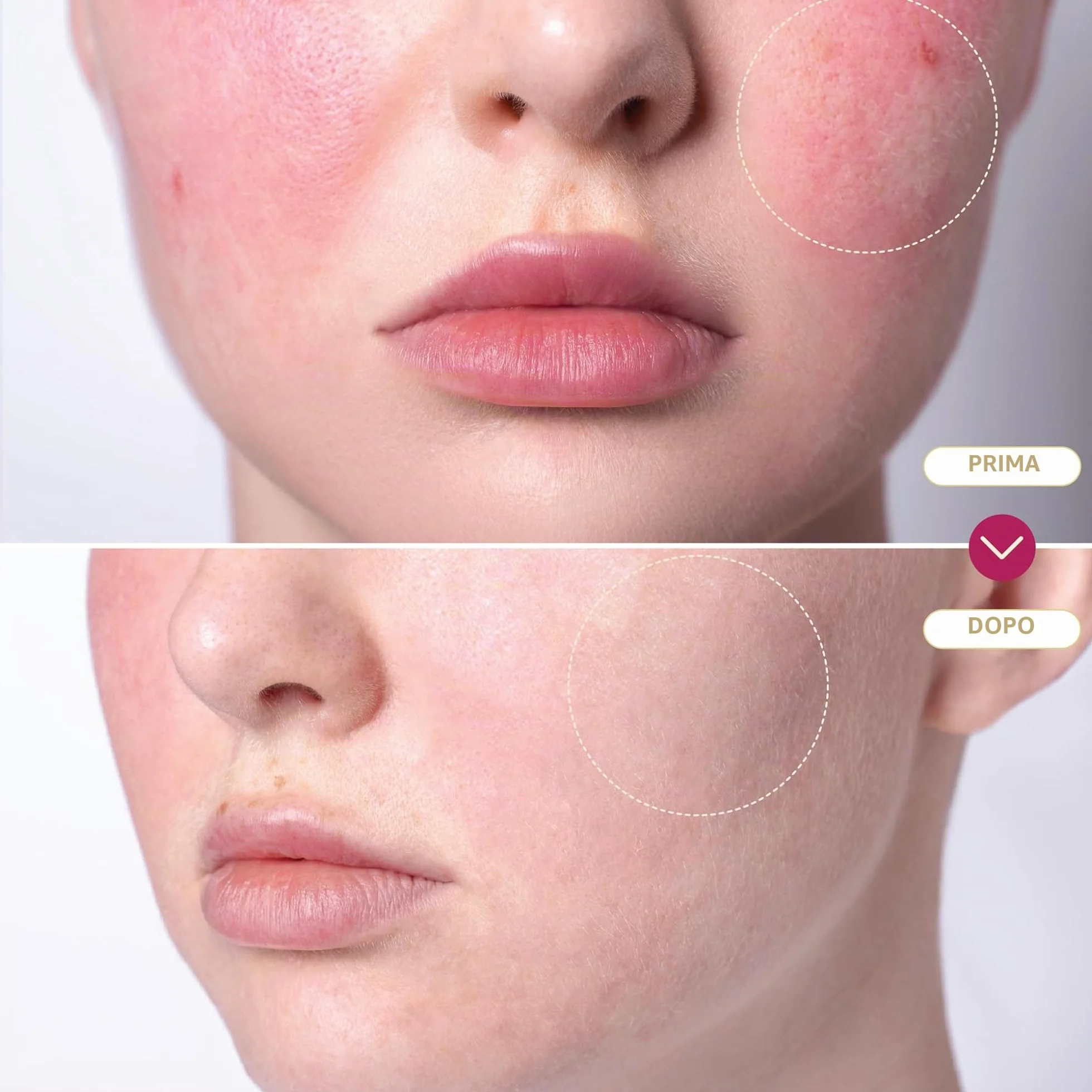 BASE LABORATORIES Spray acido ipocloroso, guarigione della pelle per ferite, soluzione spray per la cura delle ferite, eczema, tatuaggi e piercing | lavaggio delle ferite con soluzione salina